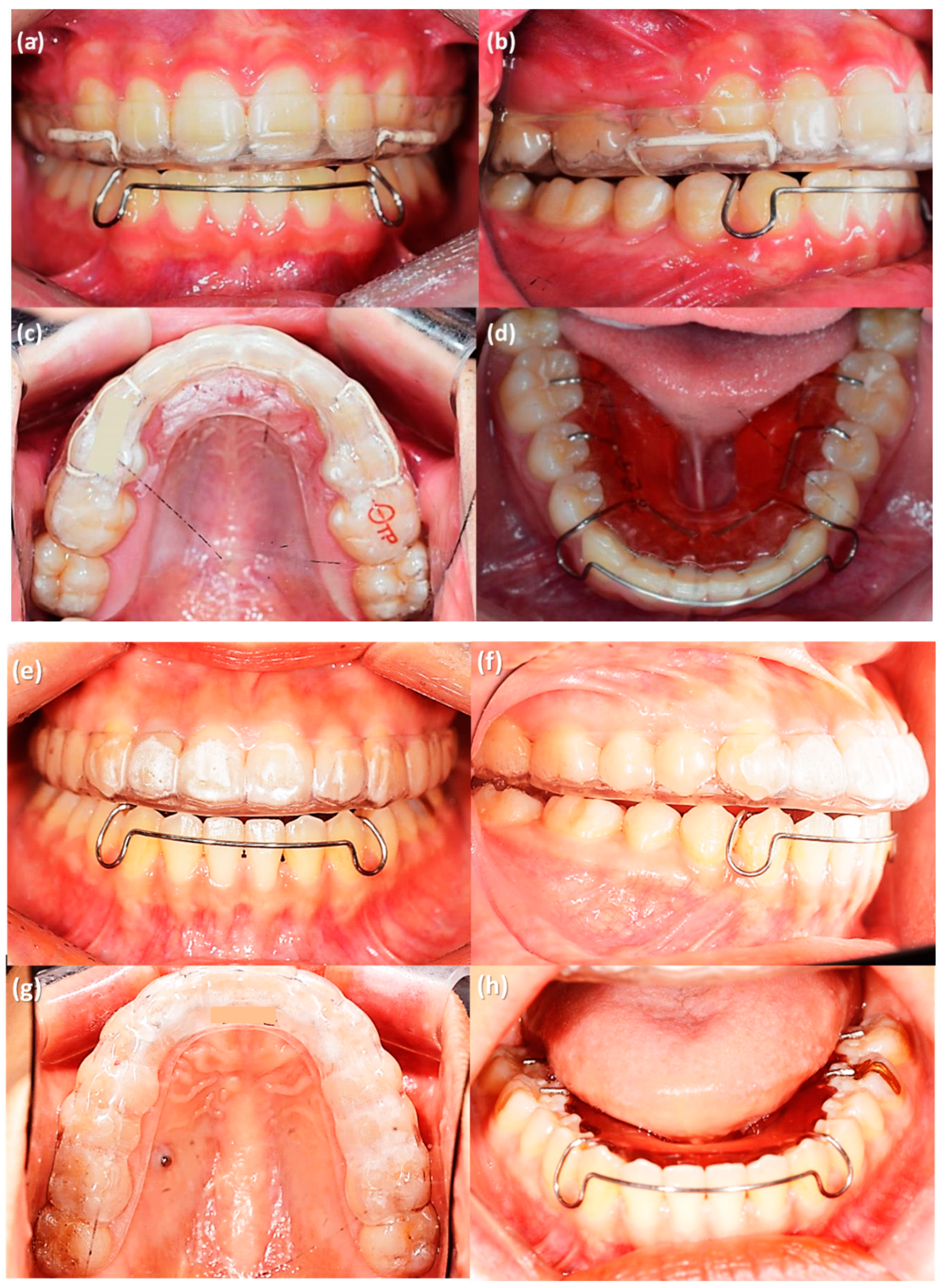 Sensors 21 00541 g004