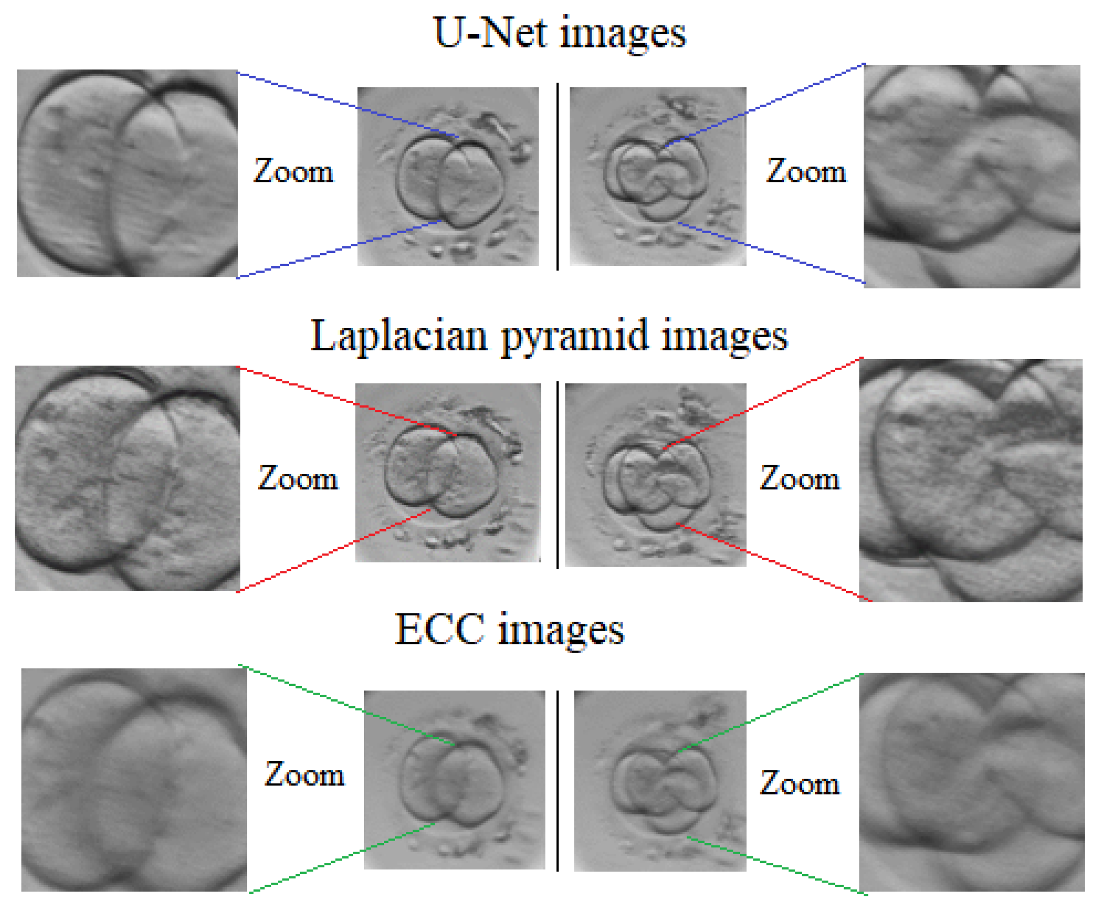 Sensors 21 00863 g011
