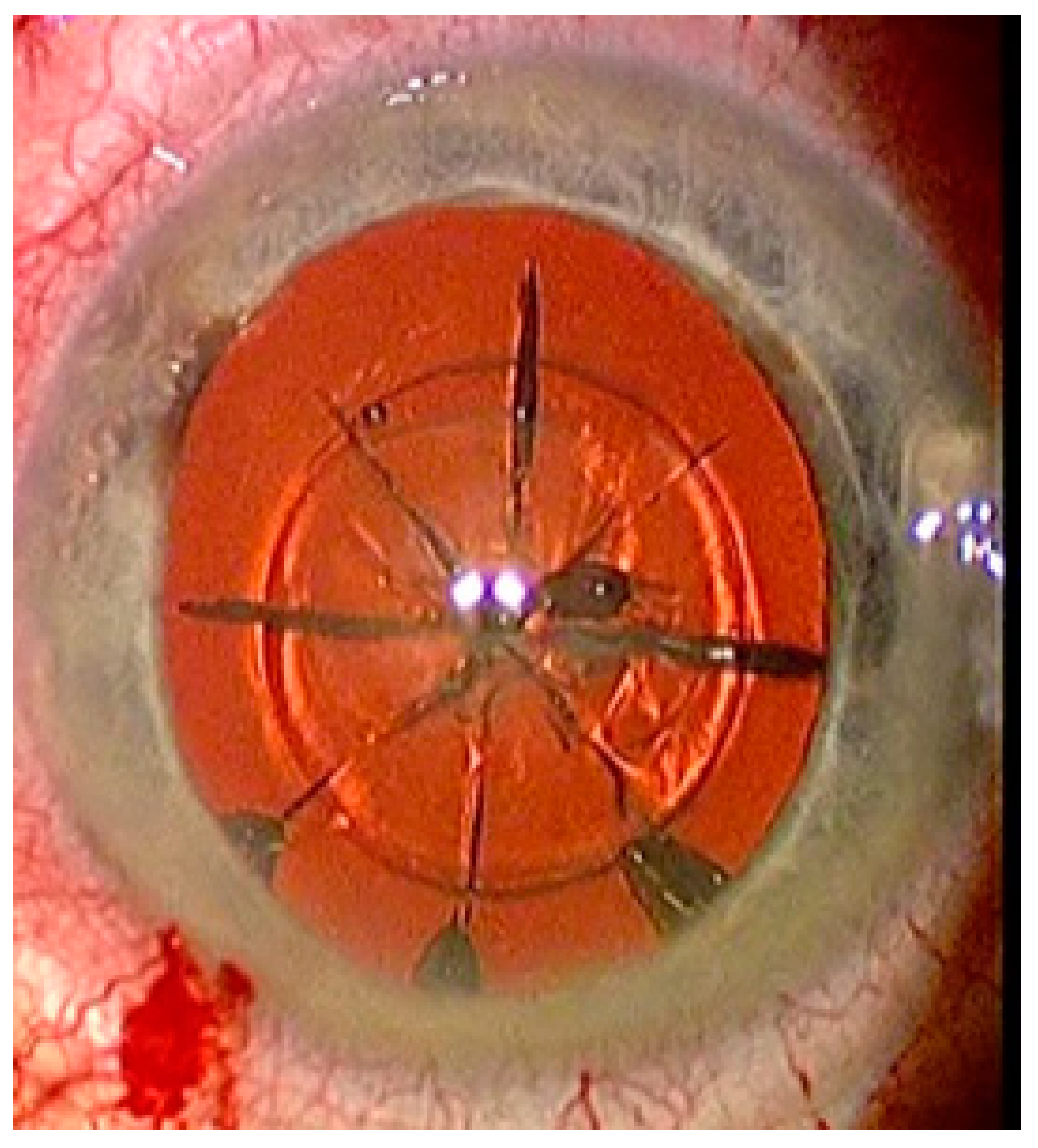 Sensors 21 00996 g004