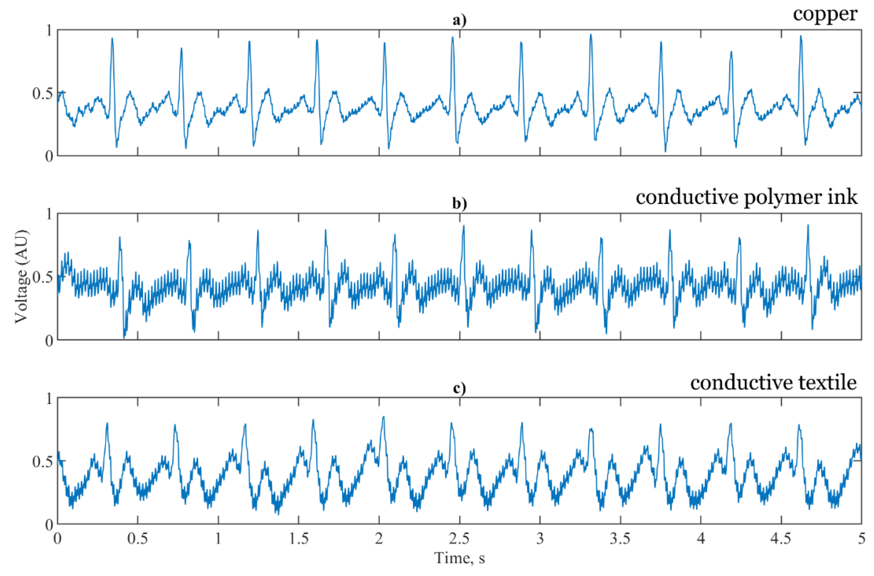 Sensors 21 00999 g011