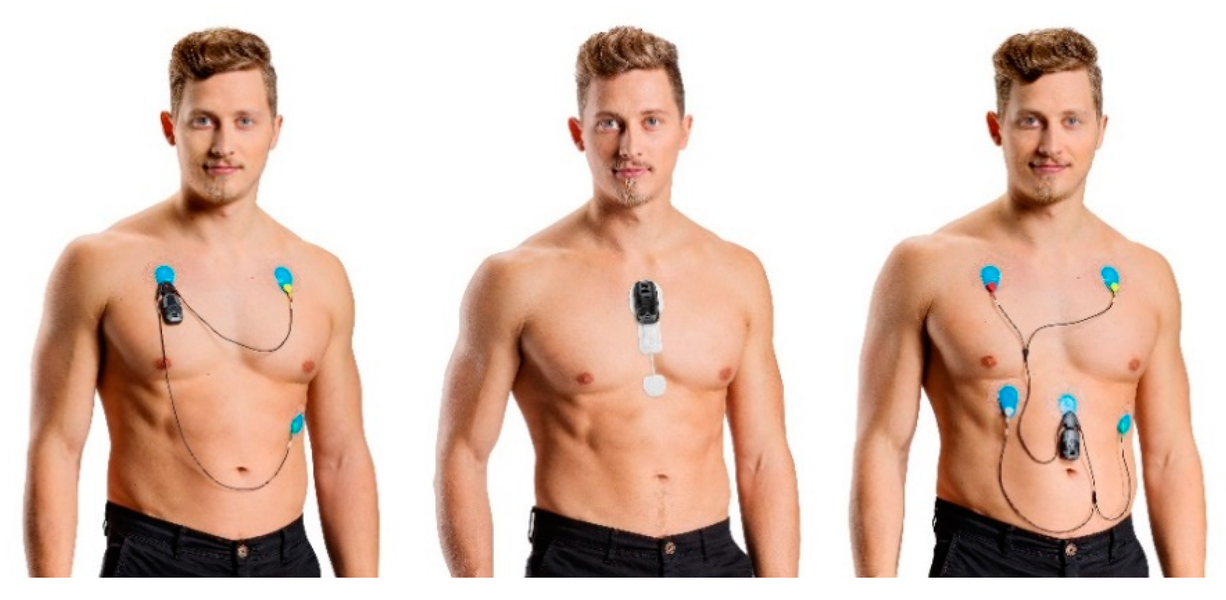 Sensors 21 01061 g001 Sensors 21 01061 g001