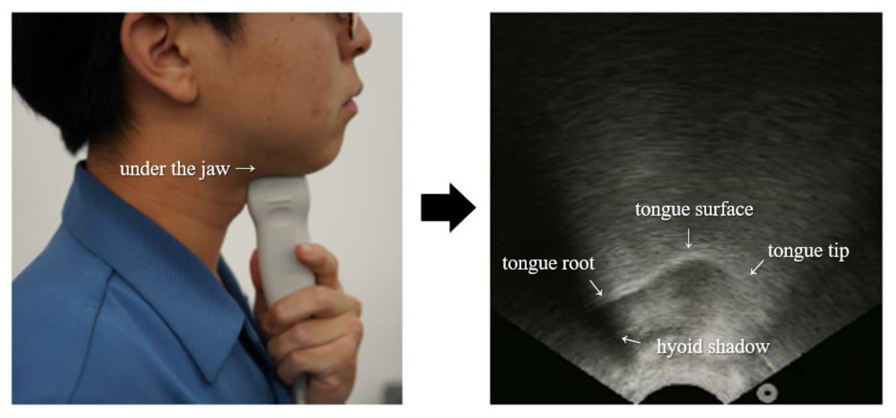 Sensors 21 01399 g010