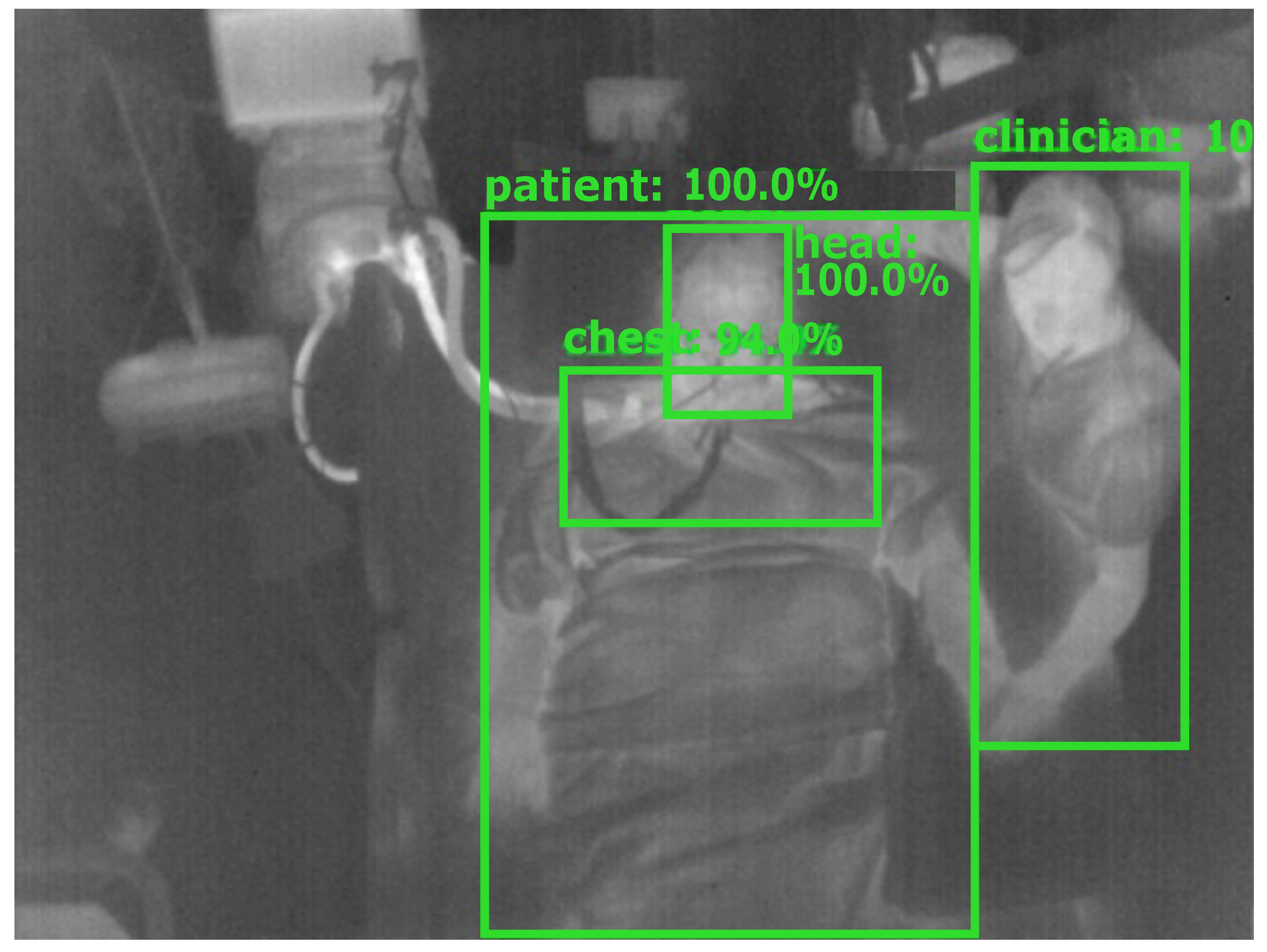 Sensors 21 01495 g004