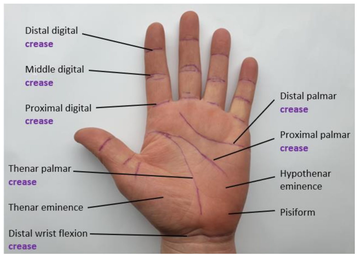 Sensors 21 01576 g003