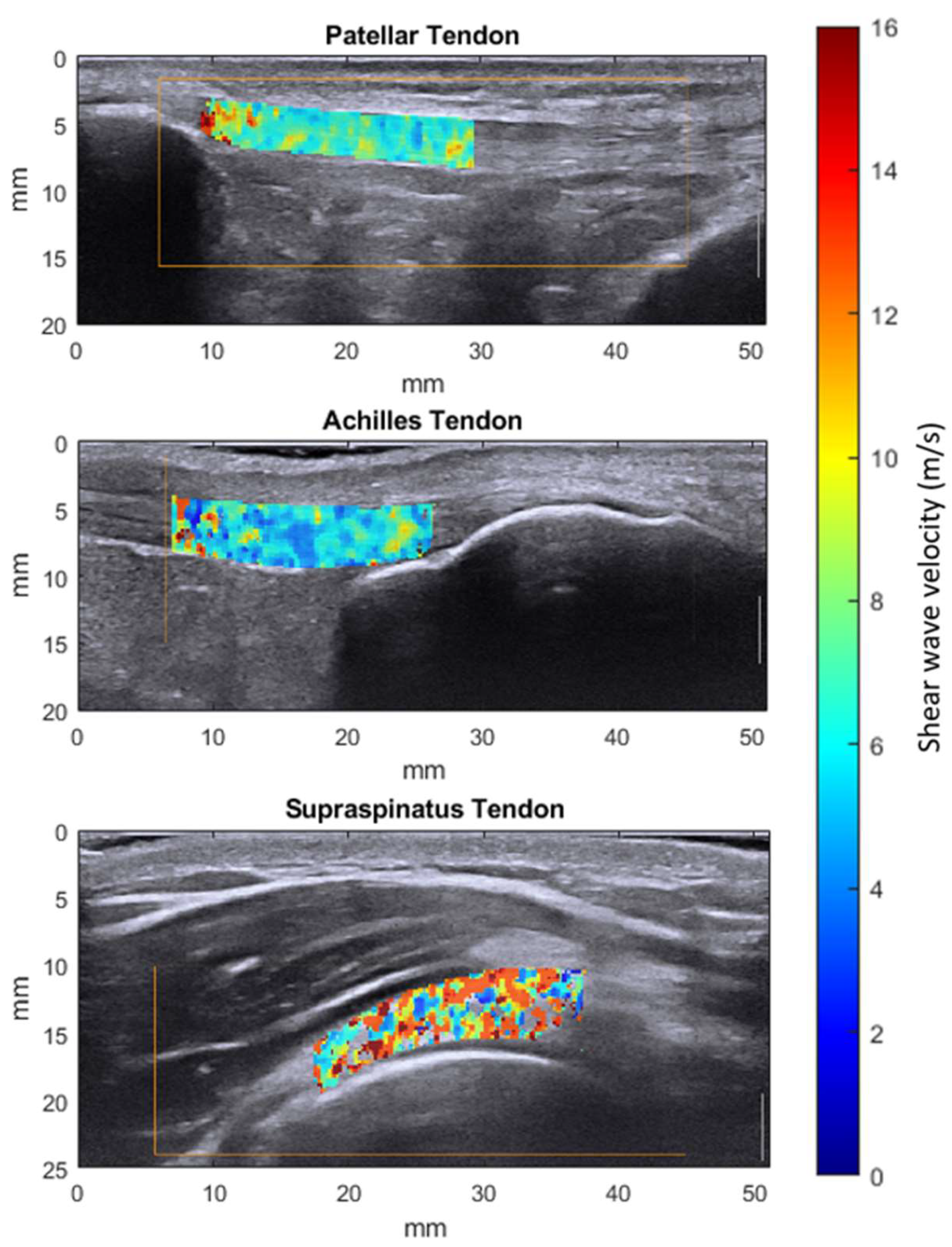 Sensors 21 01655 g002 Sensors 21 01655 g002