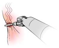 Sensors 21 01733 i002