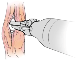 Sensors 21 01733 i003