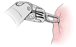 Sensors 21 01733 i004