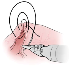 Sensors 21 01733 i006