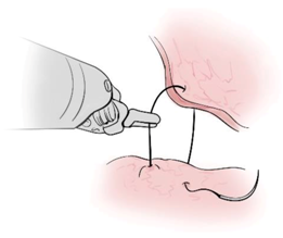 Sensors 21 01733 i008