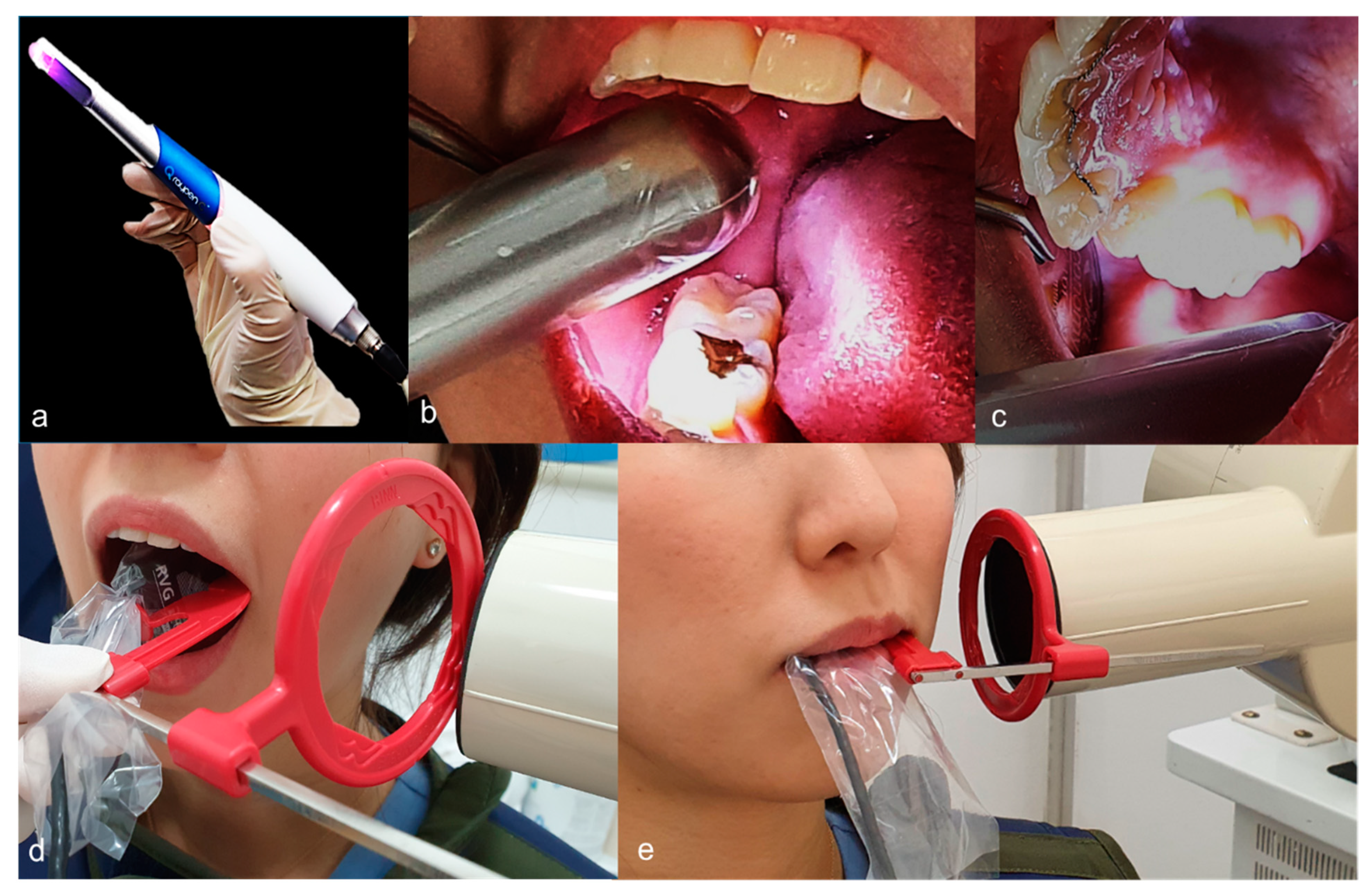 Sensors 21 01741 g002