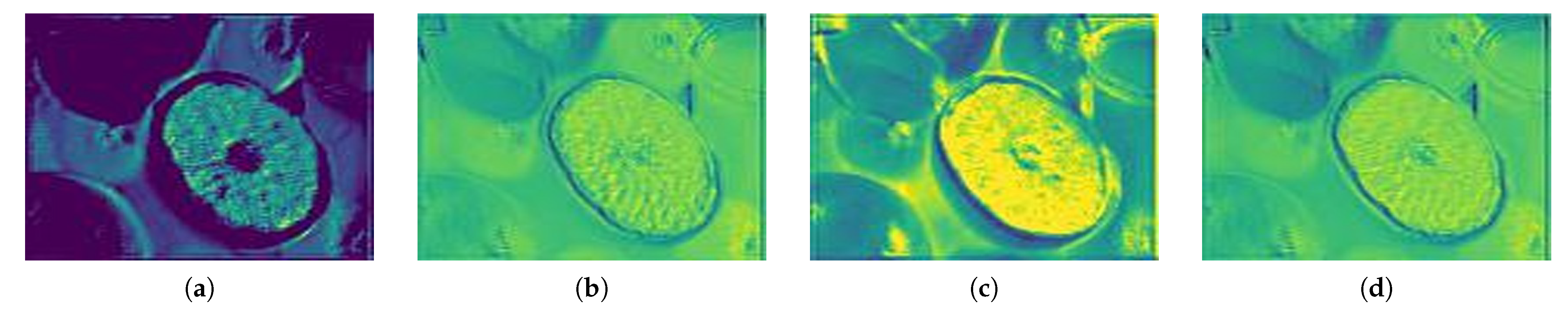 Sensors 21 01753 g007