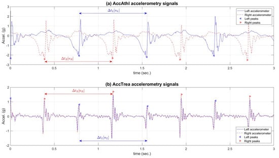 Sensors 21 01758 g0a3