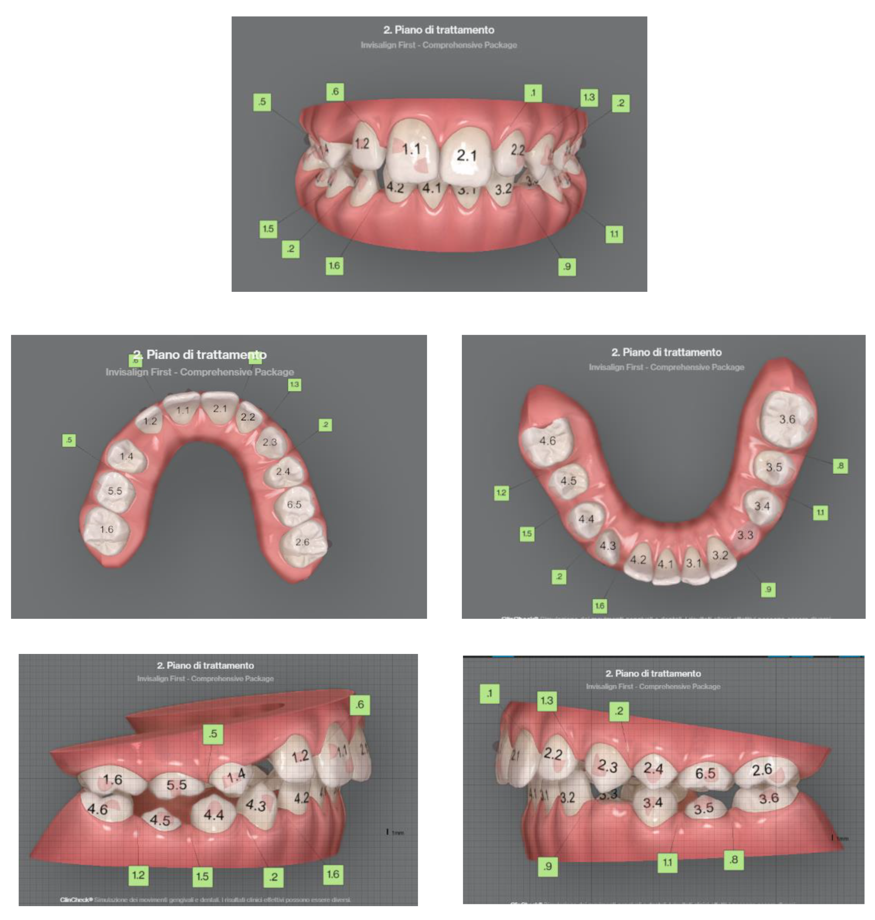 Sensors 21 01856 g006