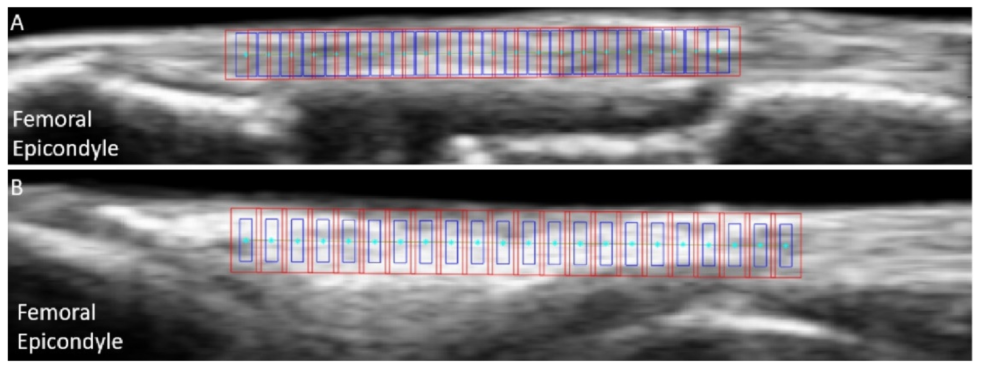 Sensors 21 01895 g003