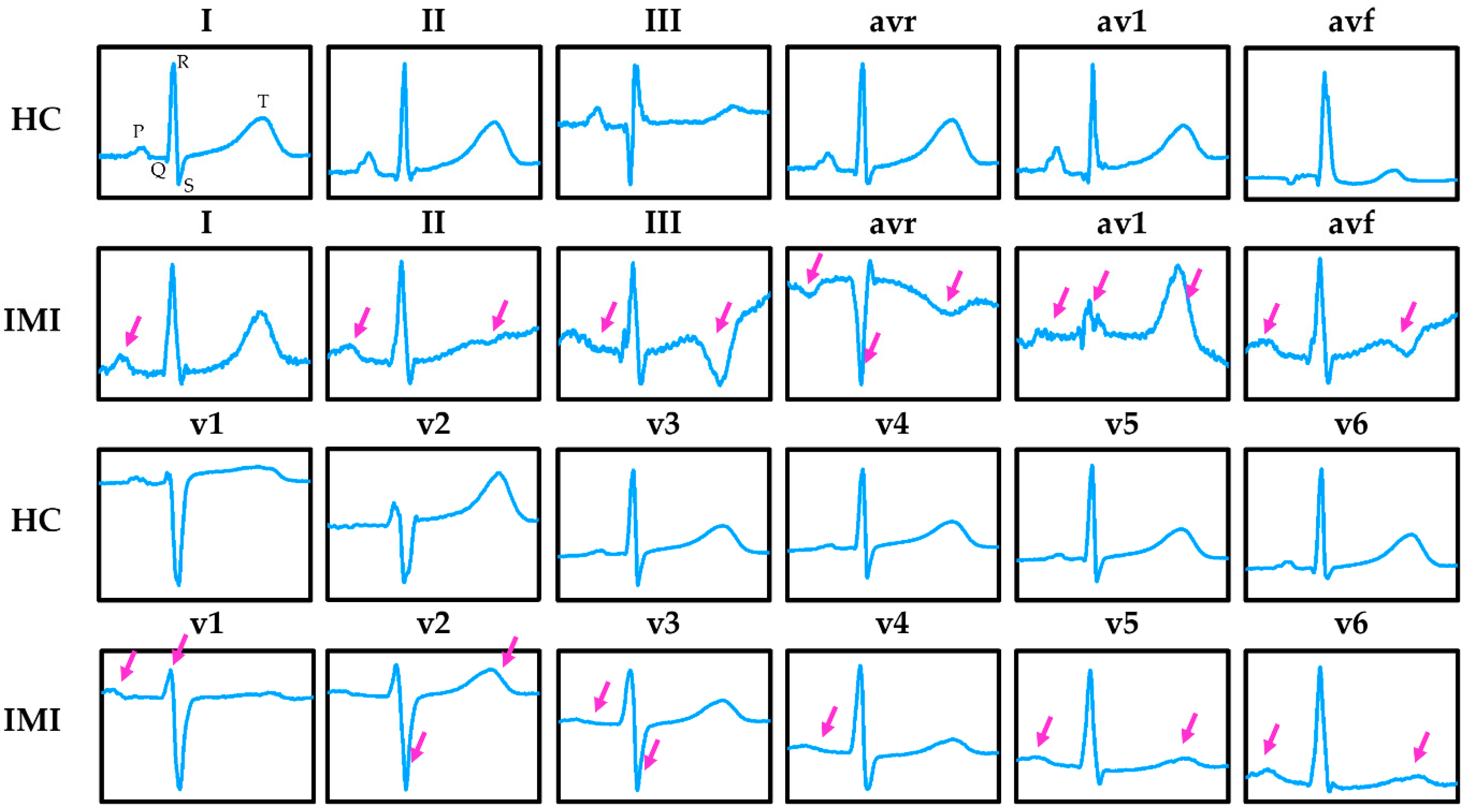 Sensors 21 01906 g004