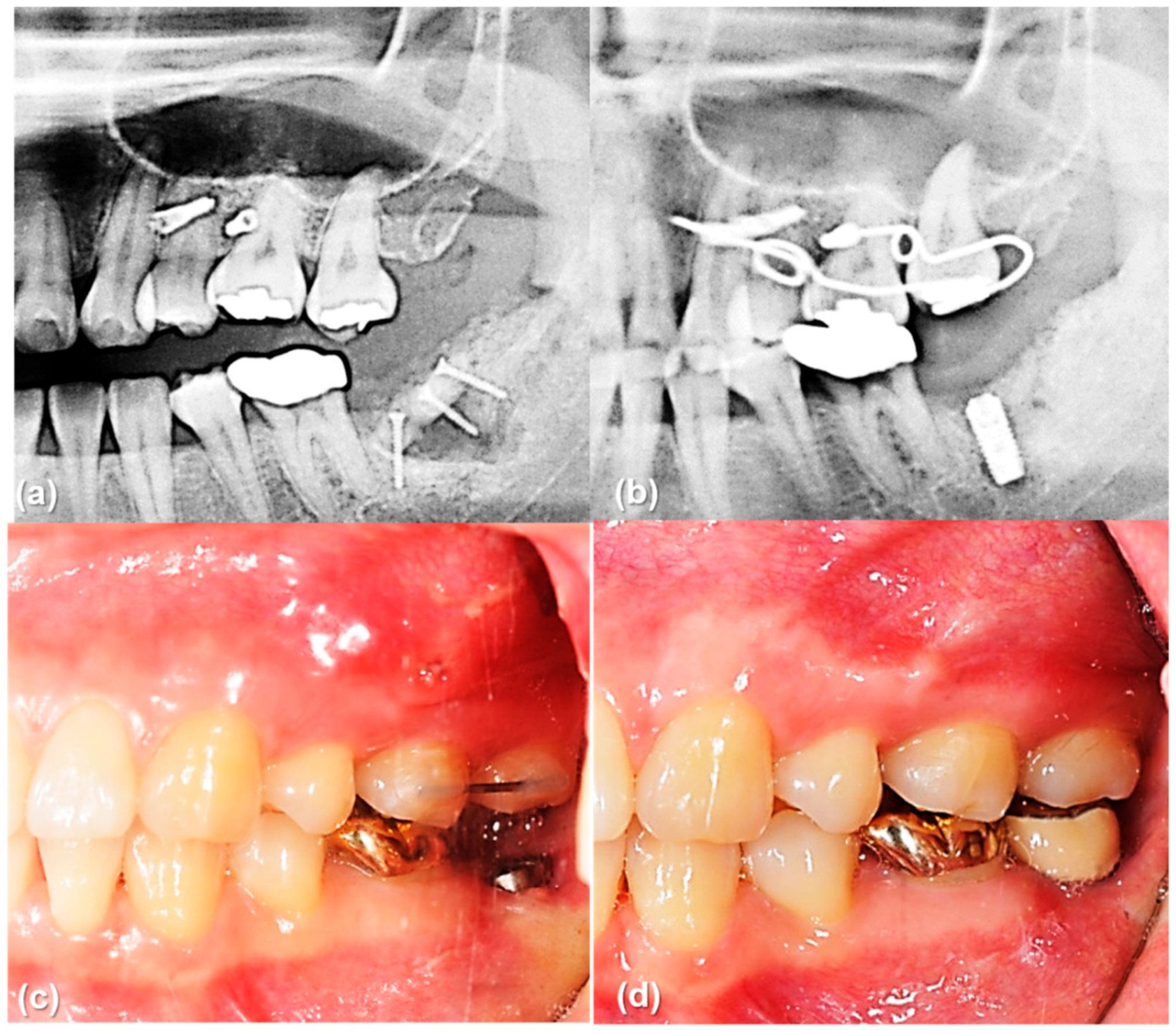 Sensors 21 01964 g010