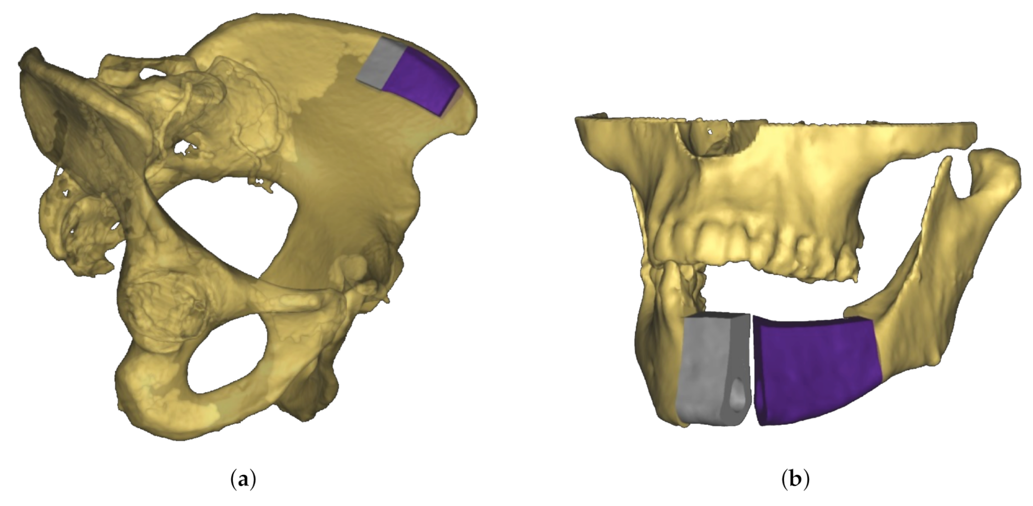 Sensors 21 02114 g001