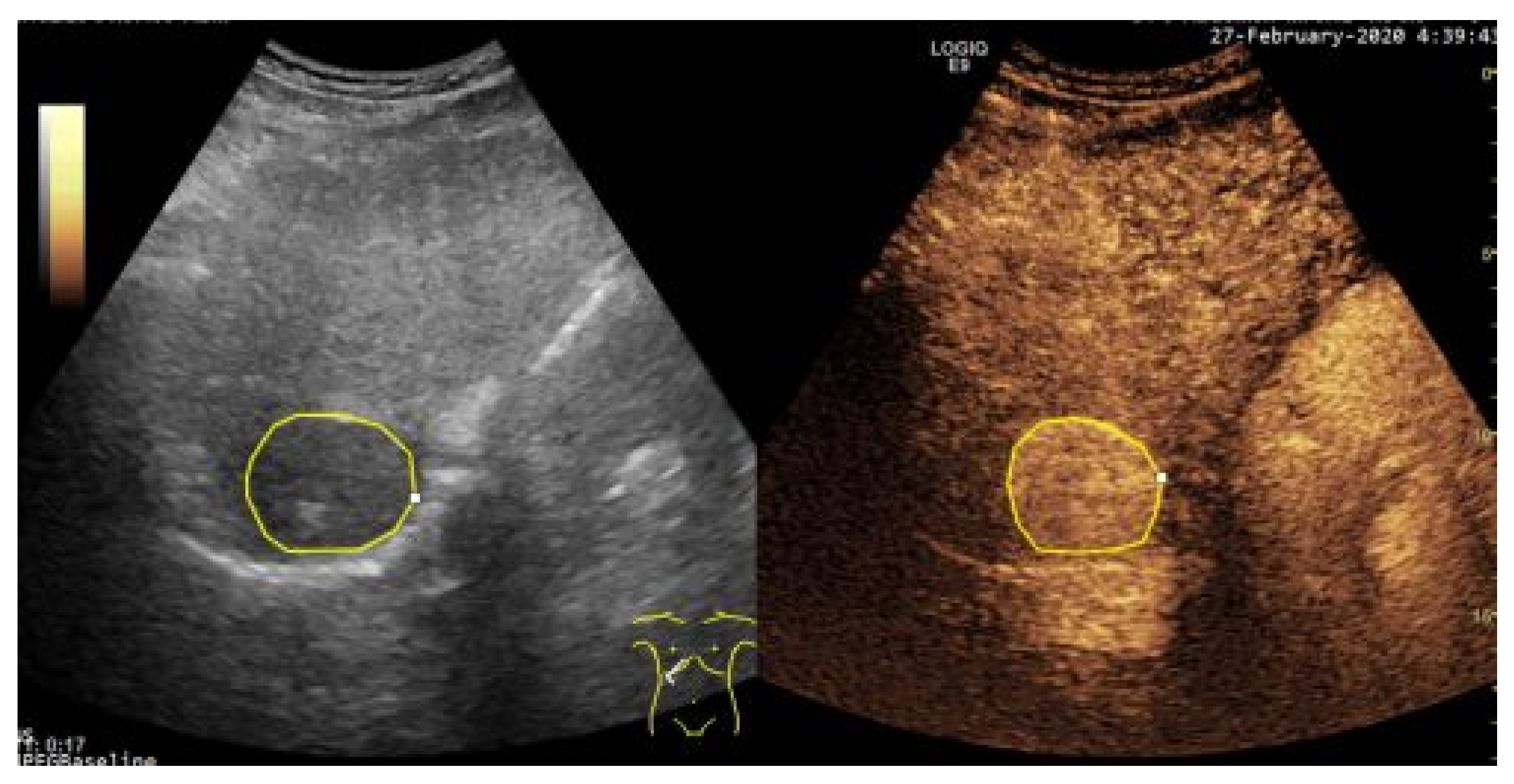 Sensors 21 02202 g001 Sensors 21 02202 g001