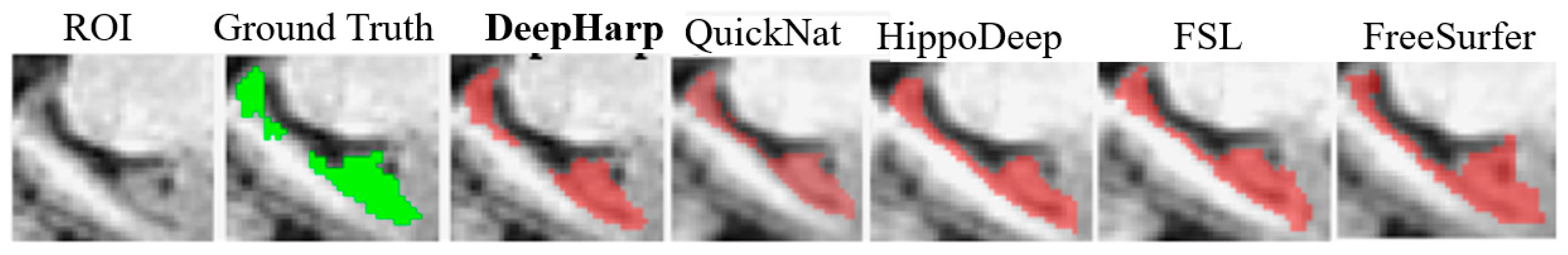 Sensors 21 02427 g006