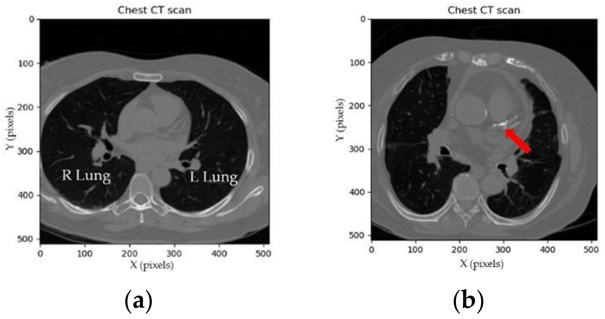 Sensors 21 02675 g0a1