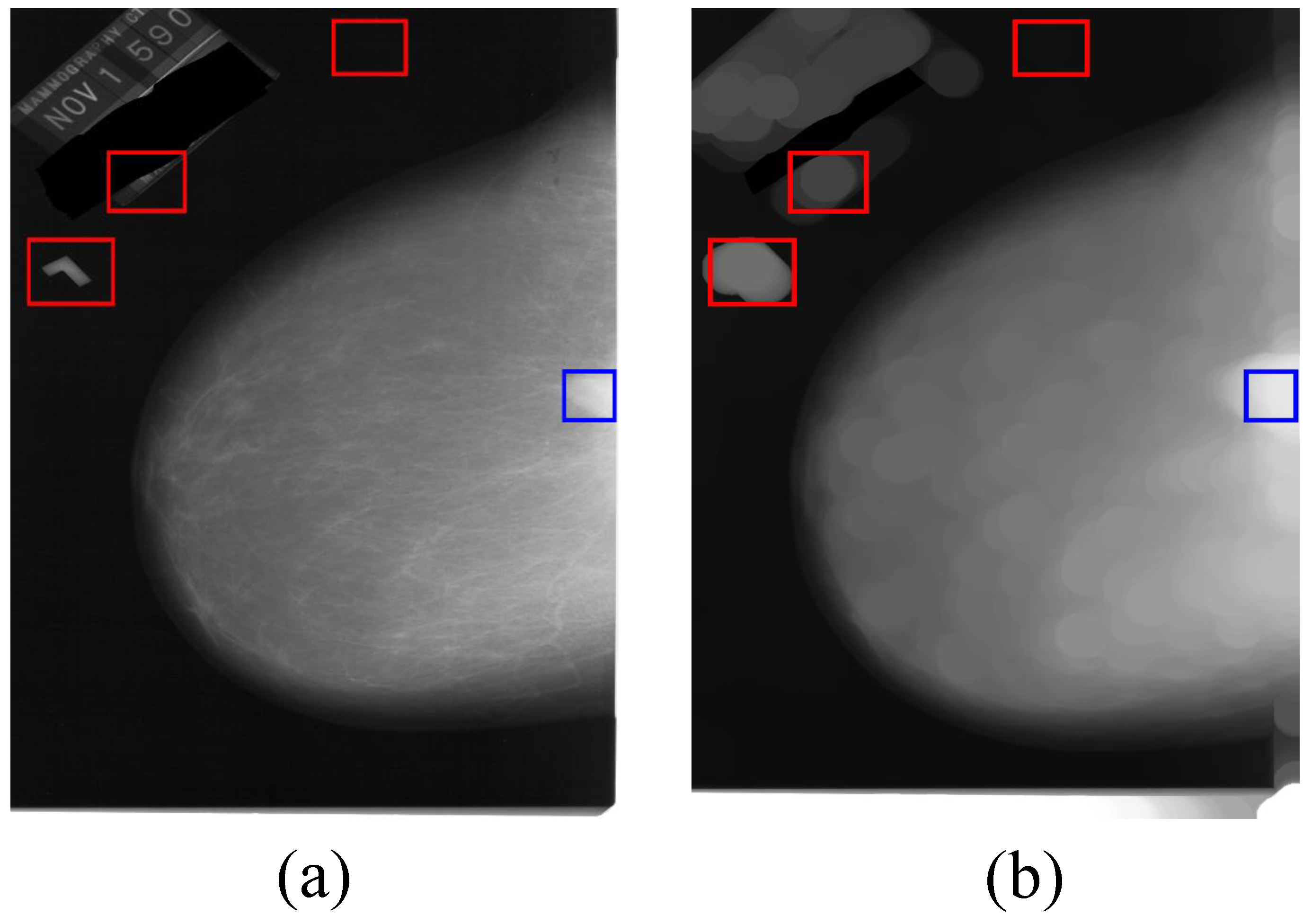 Sensors 21 02855 g011