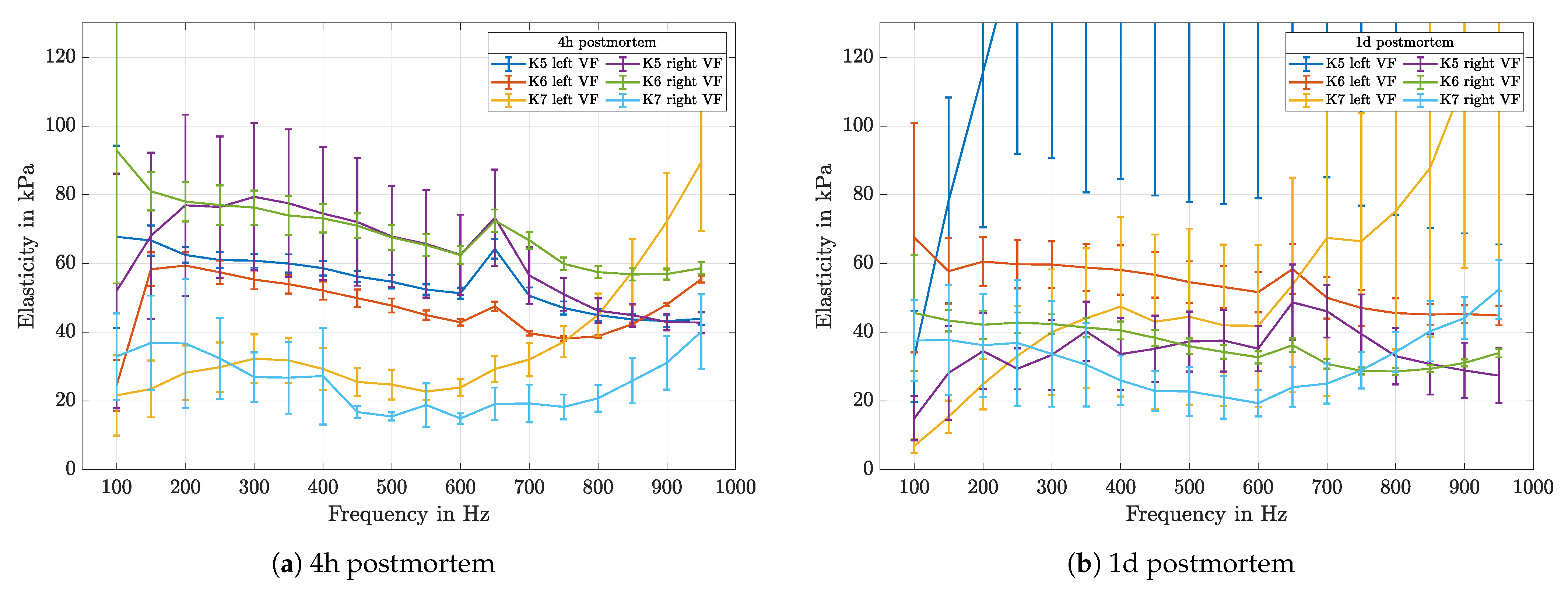 Sensors 21 02923 g012