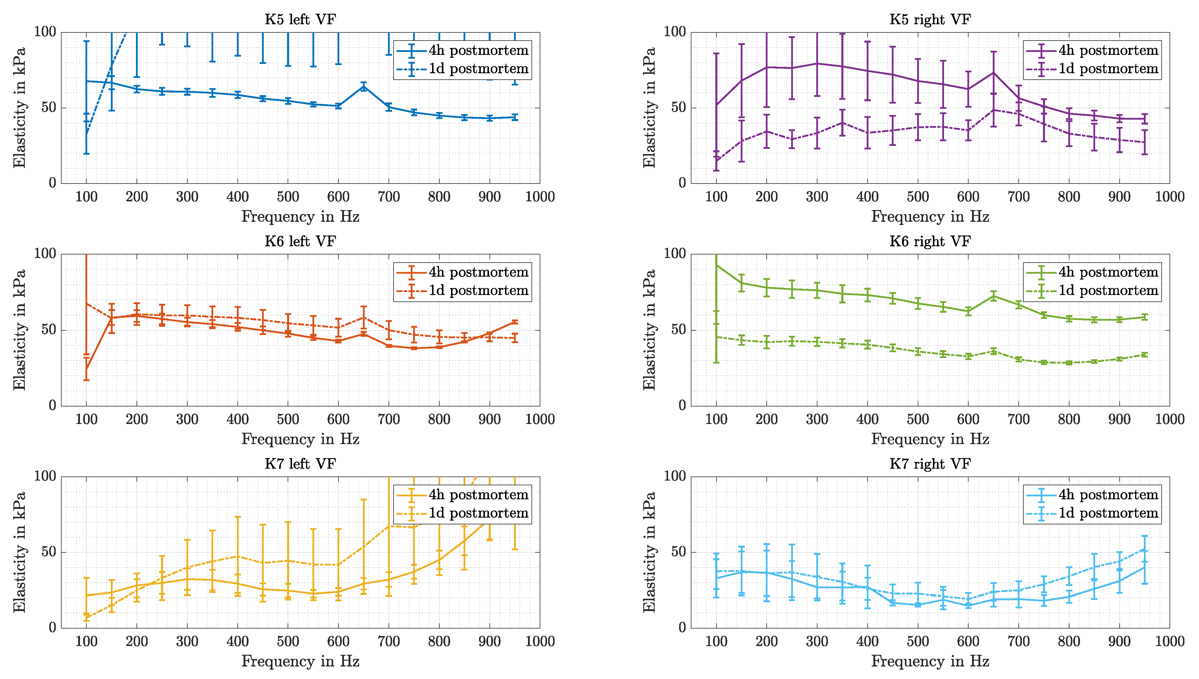 Sensors 21 02923 g015