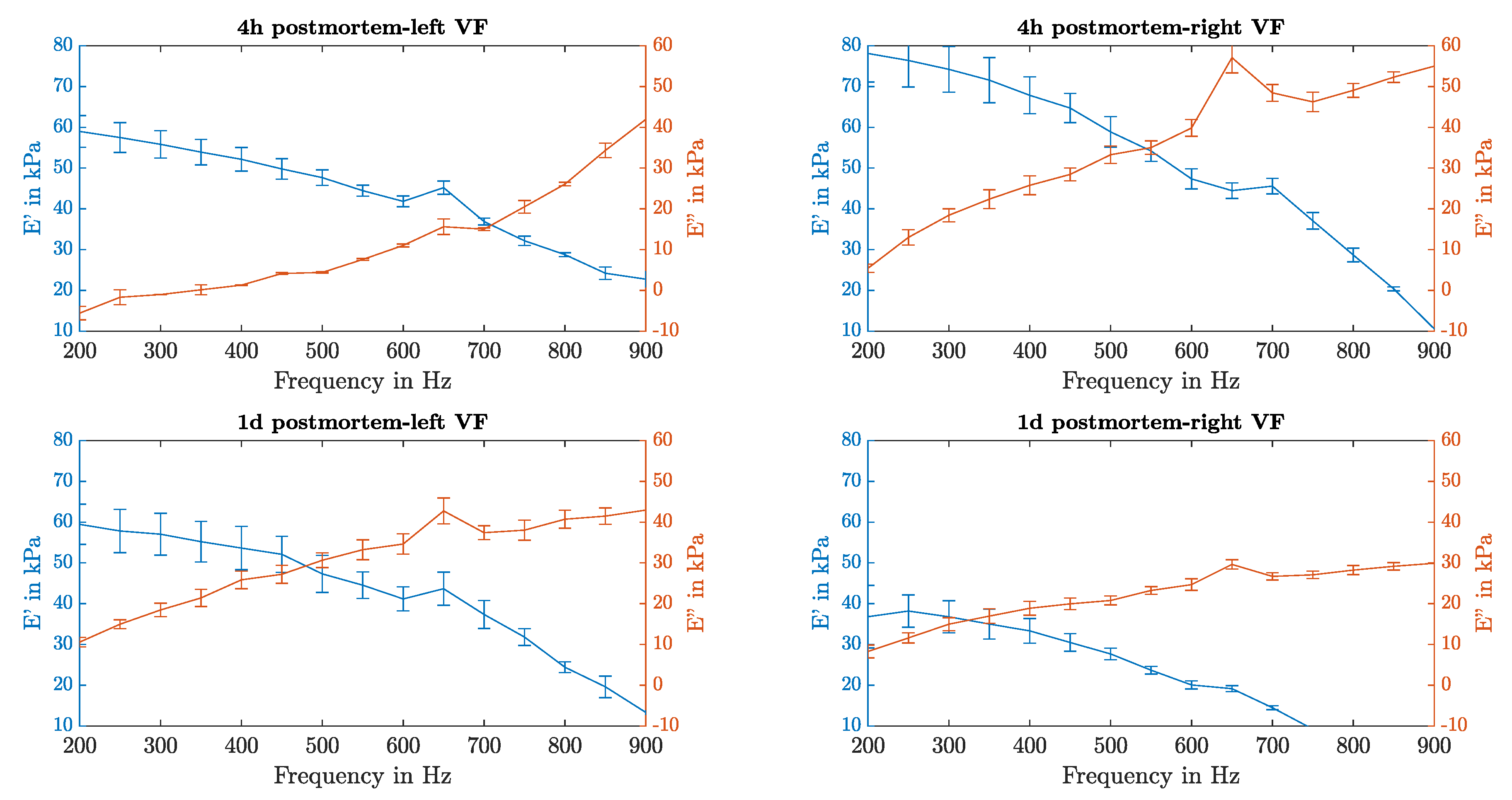 Sensors 21 02923 g017