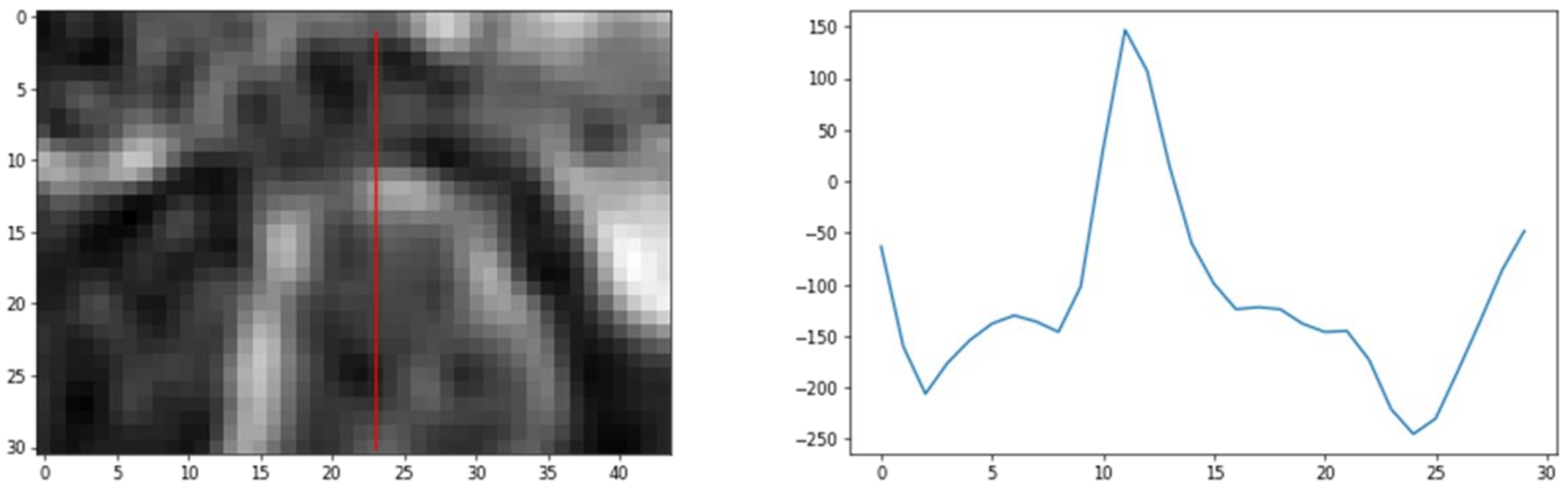 Sensors 21 03070 g006 Sensors 21 03070 g006
