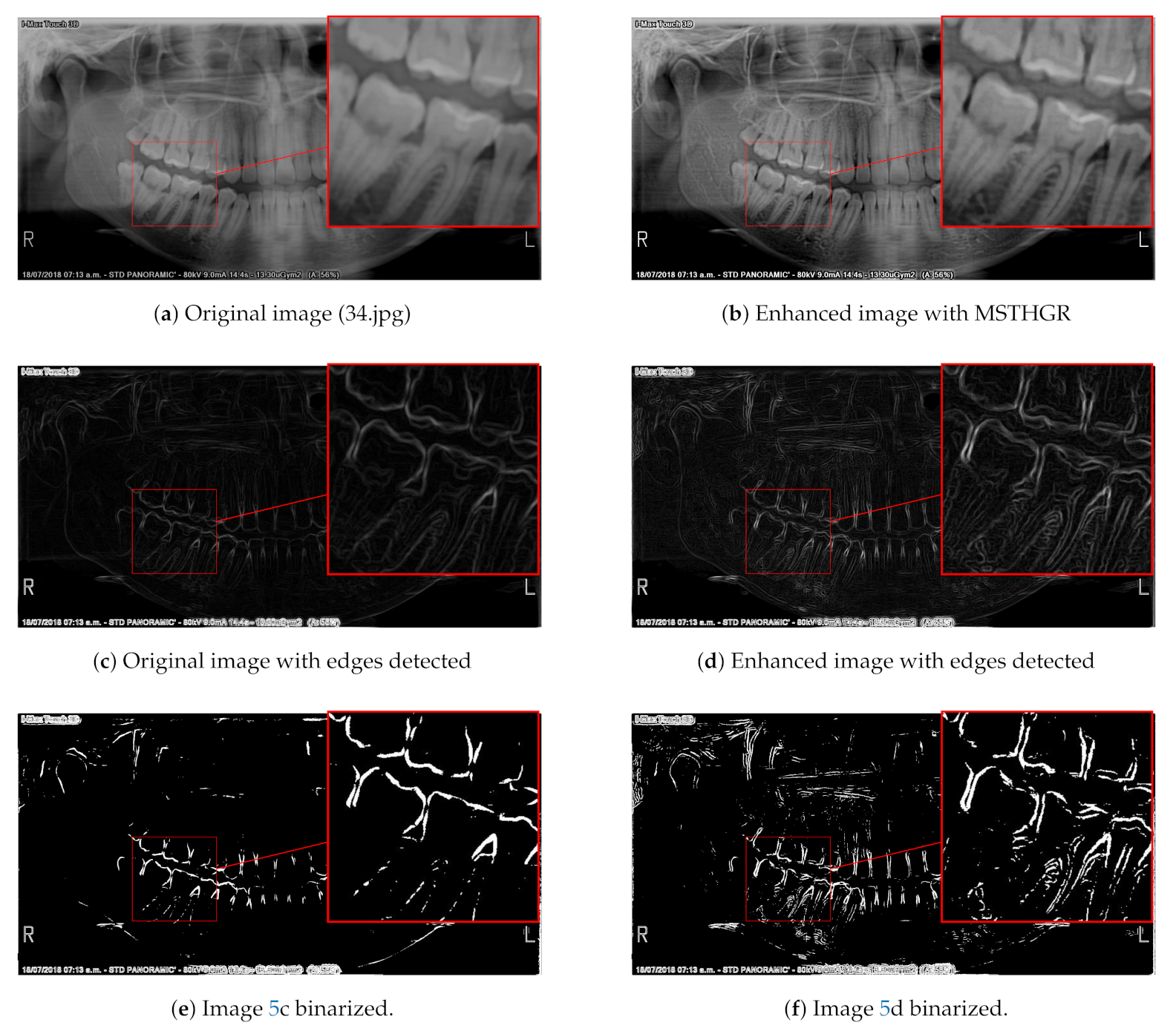 Sensors 21 03110 g005