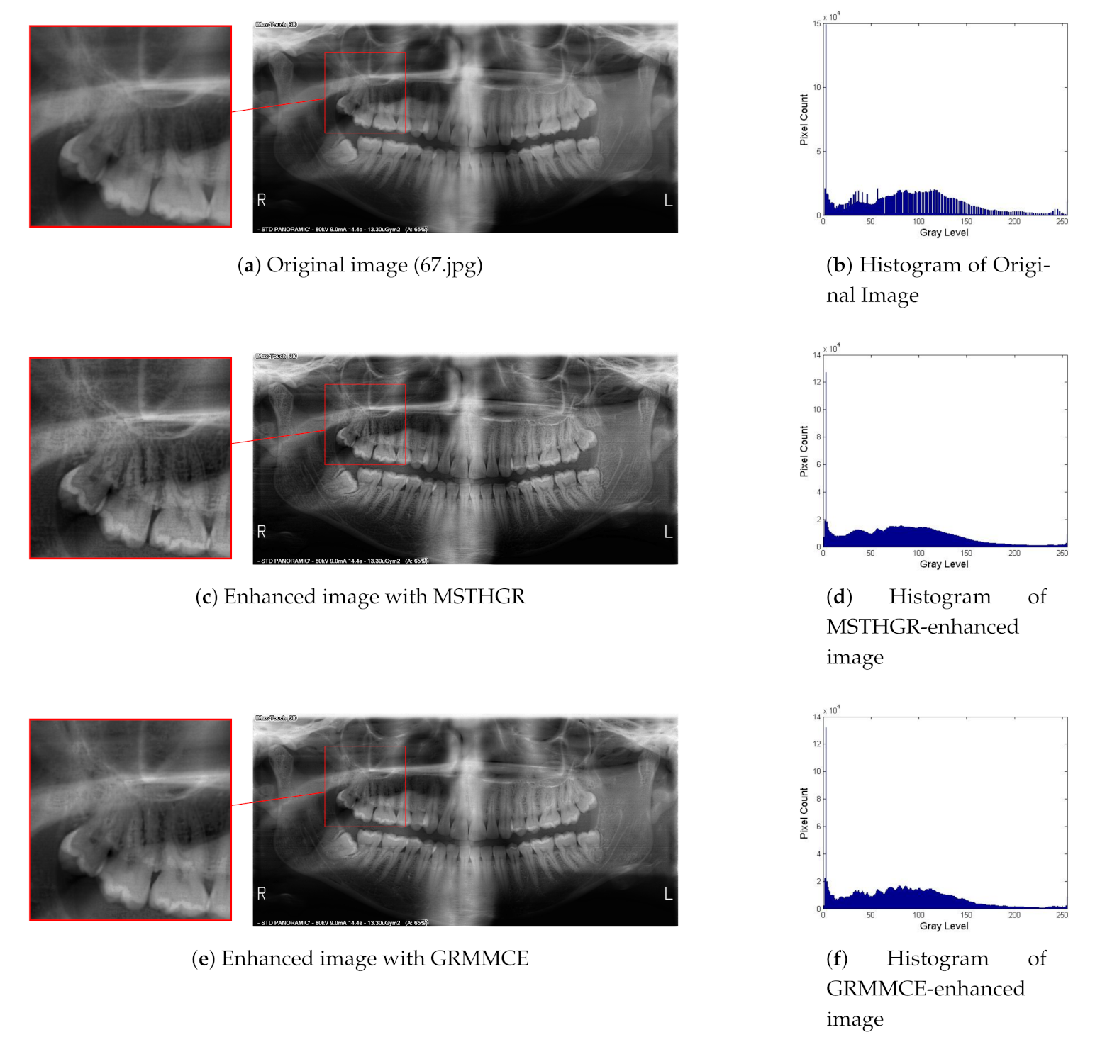 Sensors 21 03110 g007a