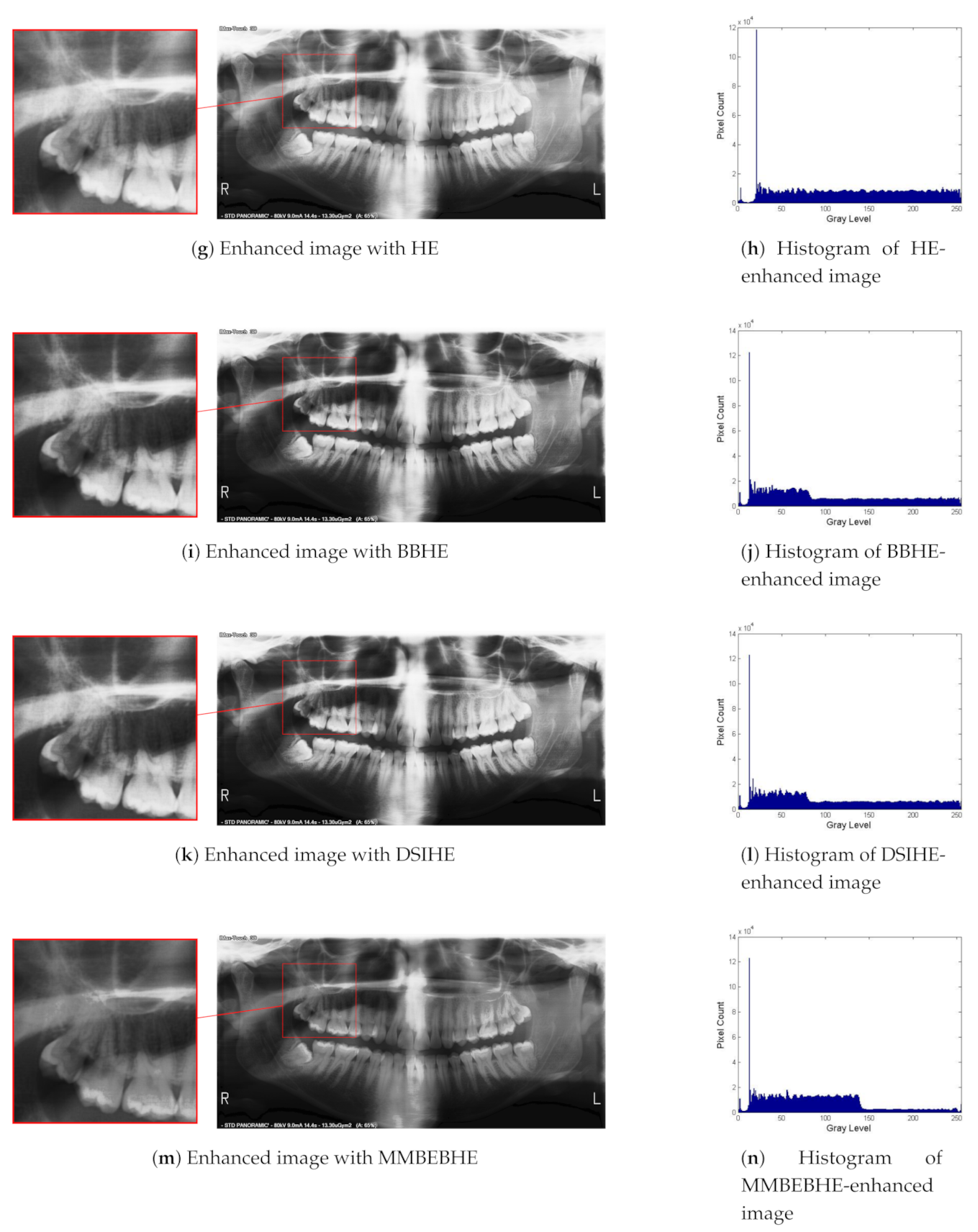 Sensors 21 03110 g007b