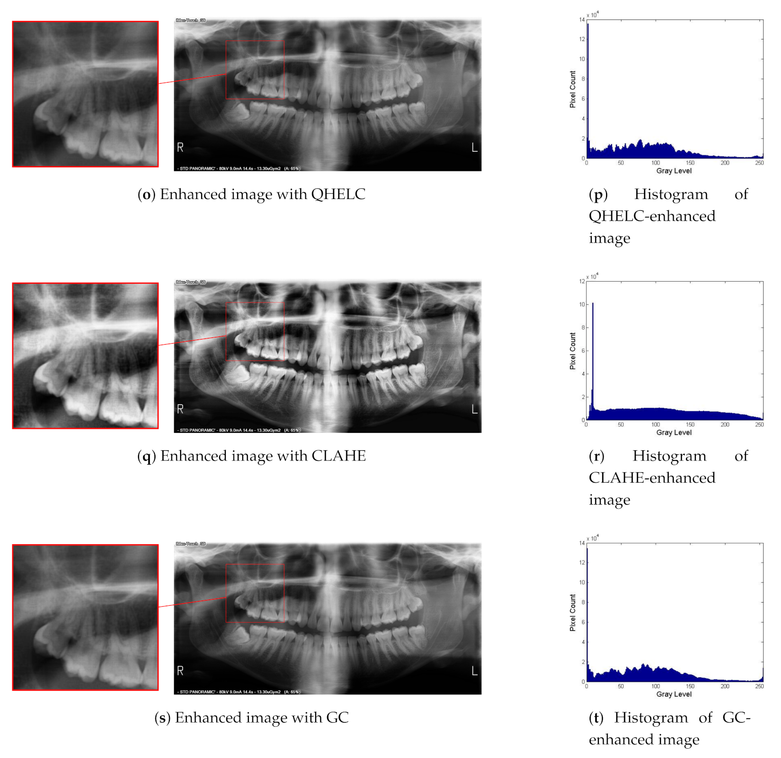 Sensors 21 03110 g007c