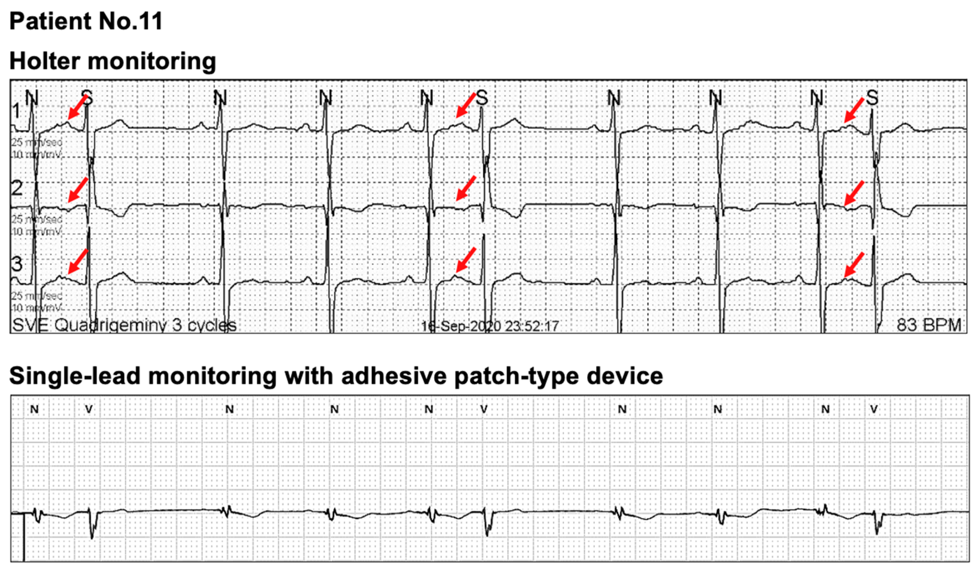 Sensors 21 03122 g004 Sensors 21 03122 g004