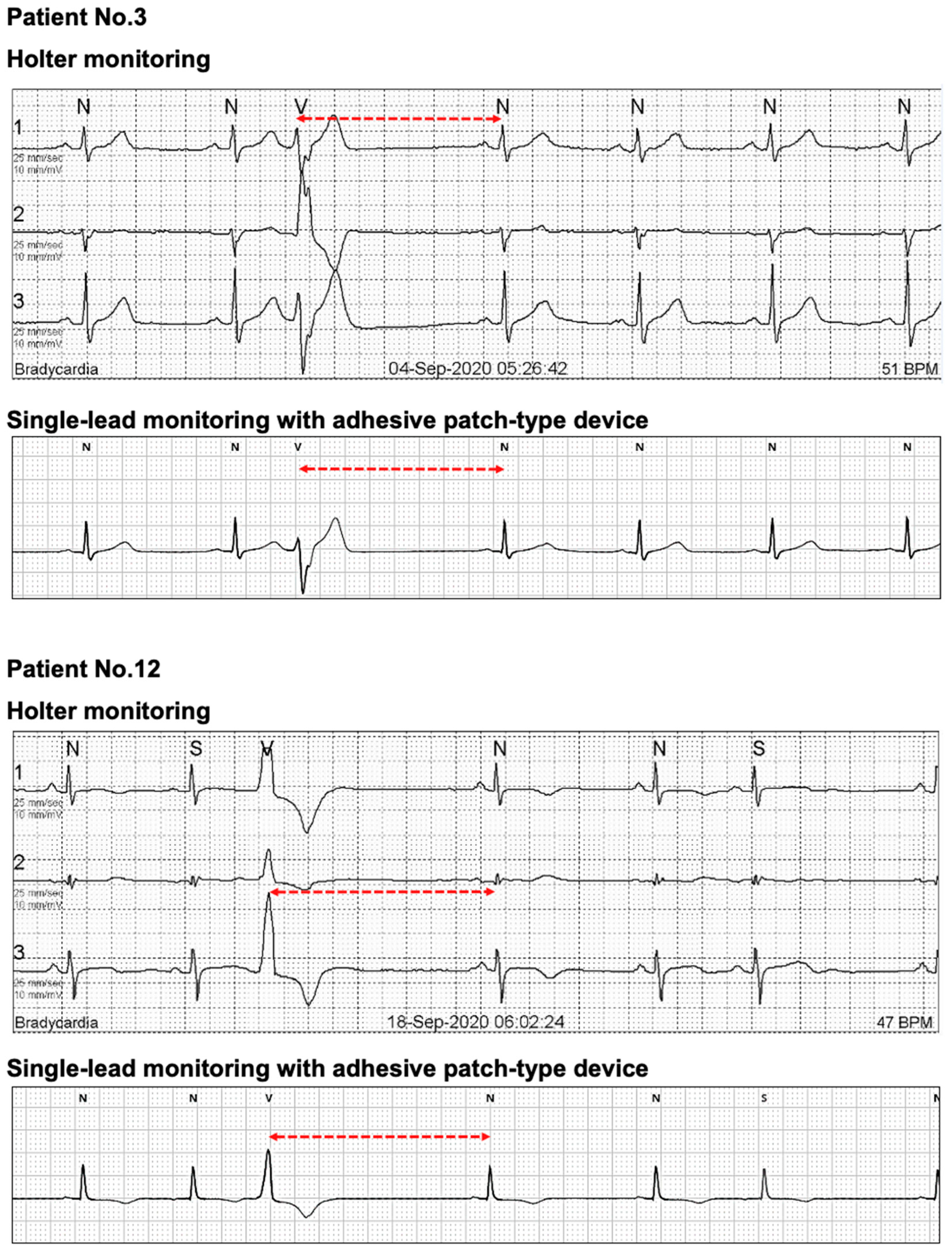 Sensors 21 03122 g008 Sensors 21 03122 g008