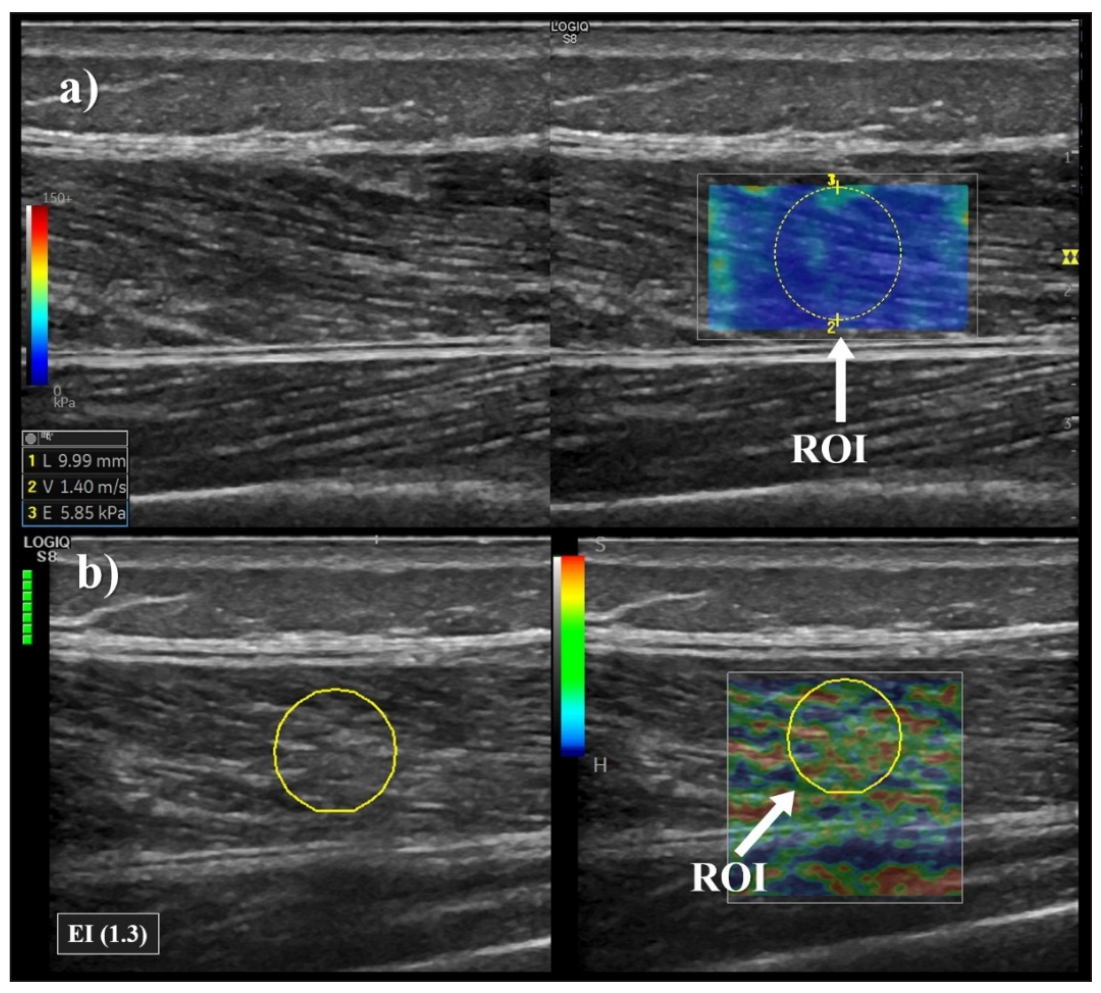 Sensors 21 03213 g003