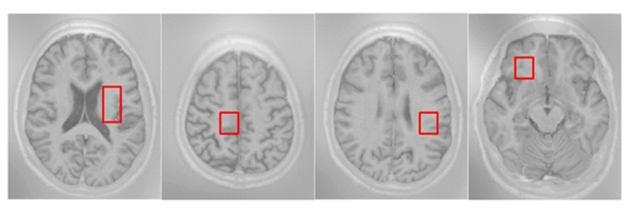 Sensors 21 03232 g003