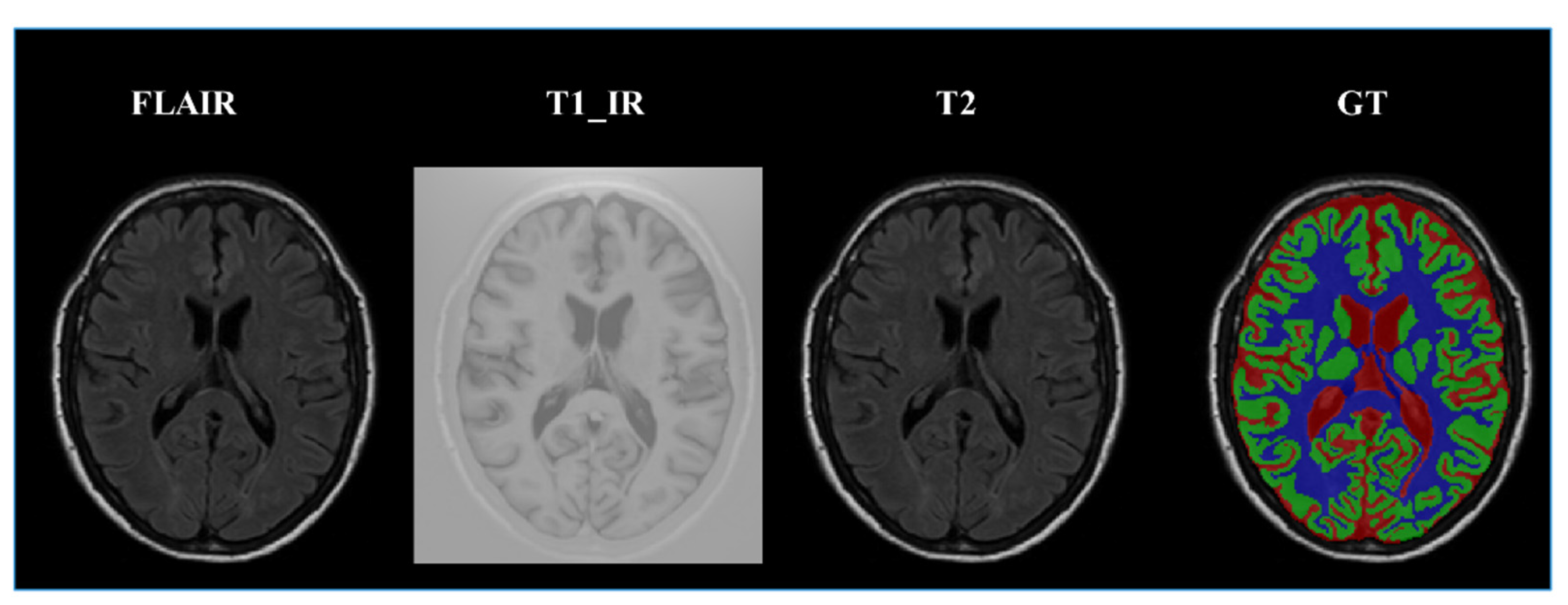 Sensors 21 03232 g006