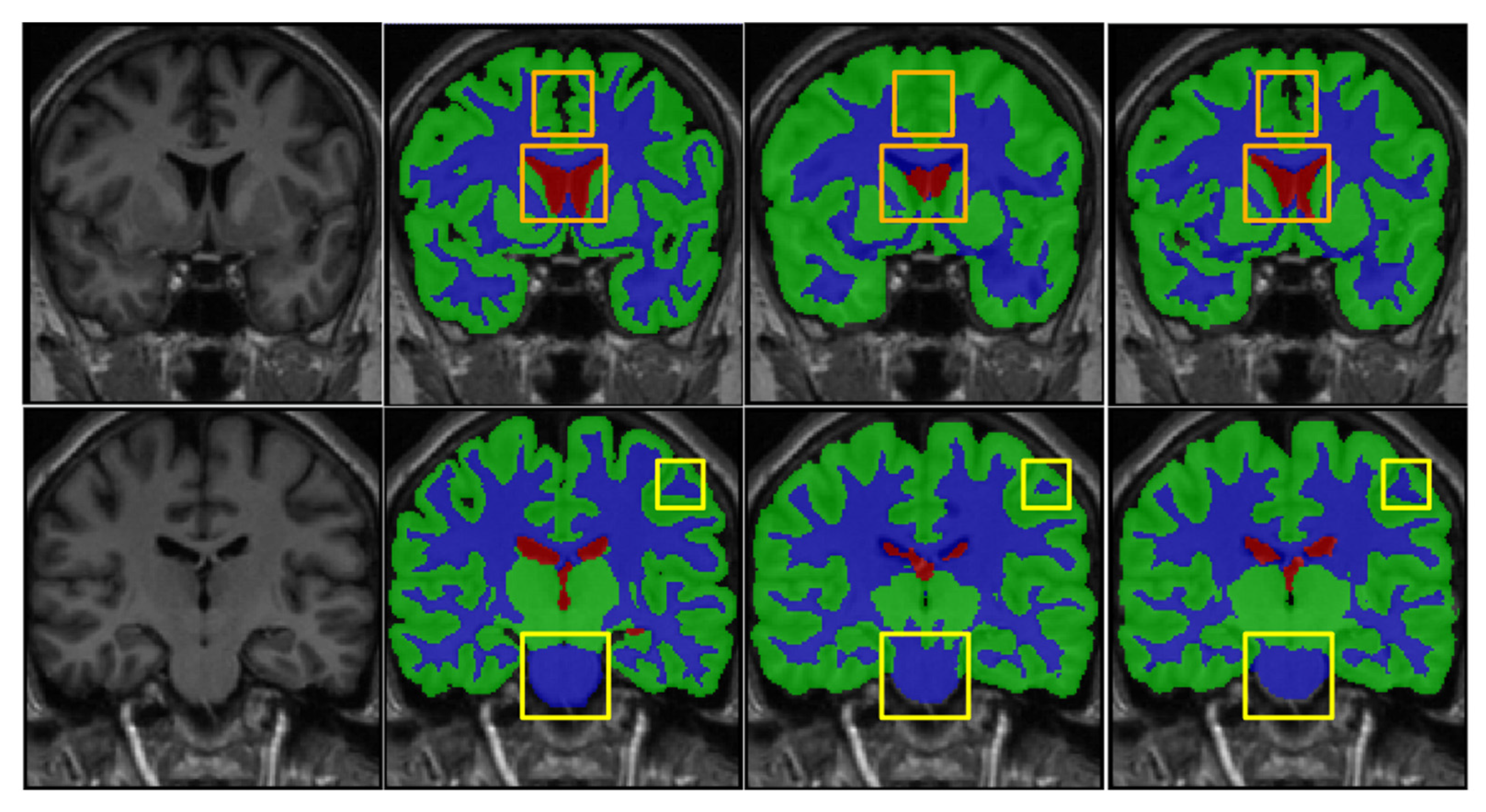 Sensors 21 03232 g008