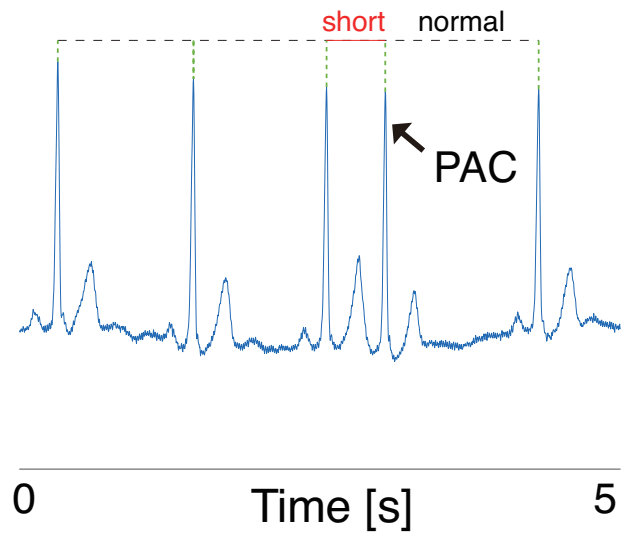 Sensors 21 03235 g003