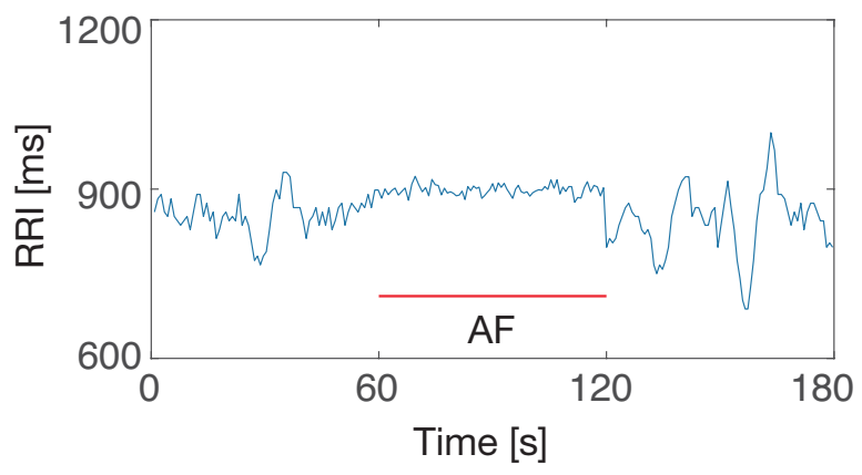 Sensors 21 03235 g013