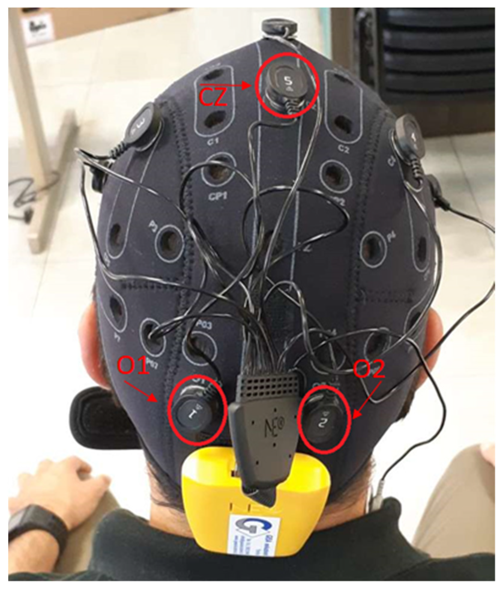 Sensors 21 03345 g003