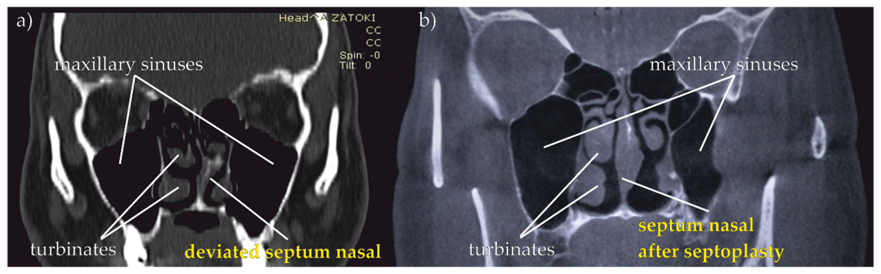 Sensors 21 03479 g019