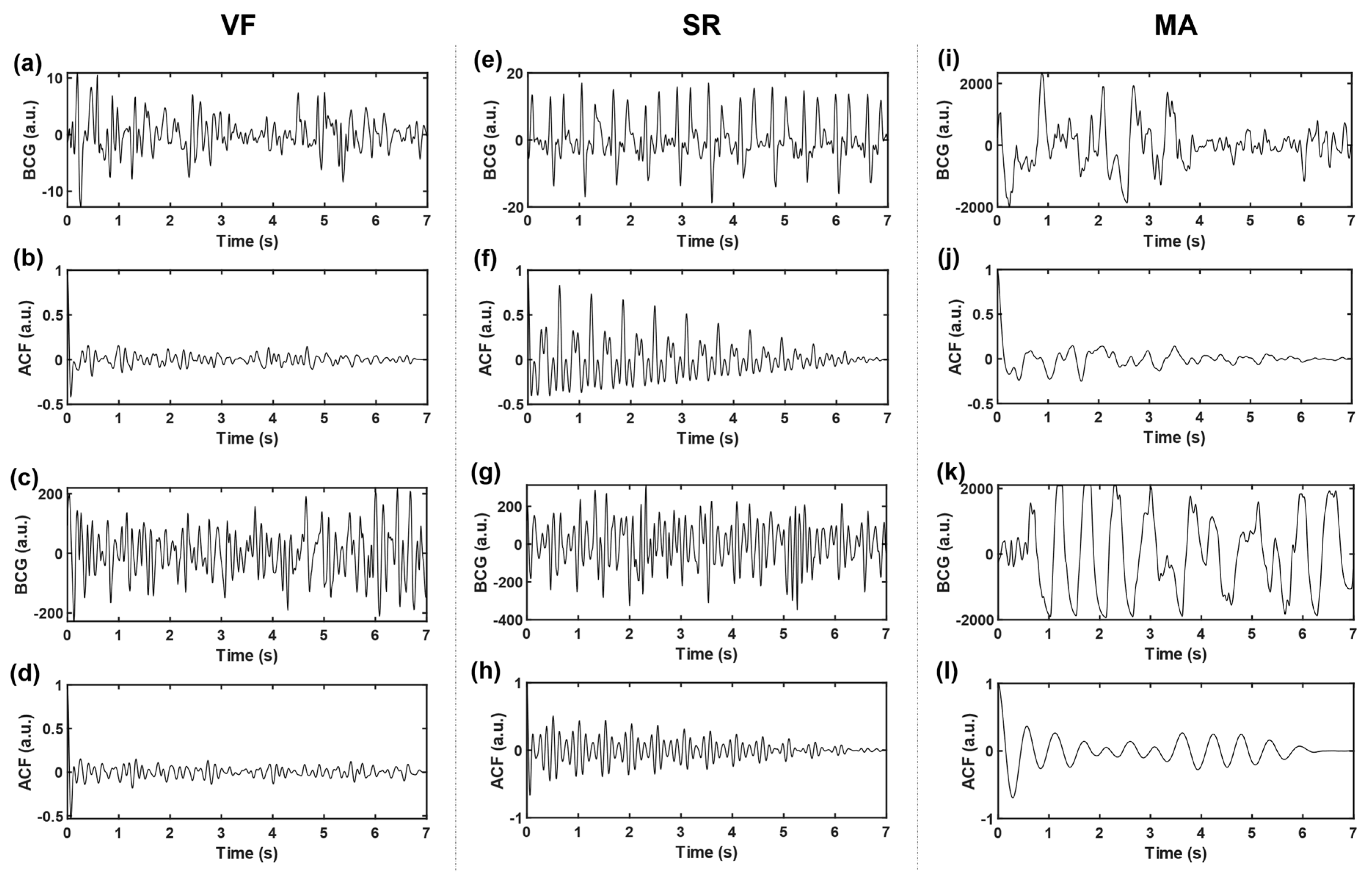 Sensors 21 03524 g004