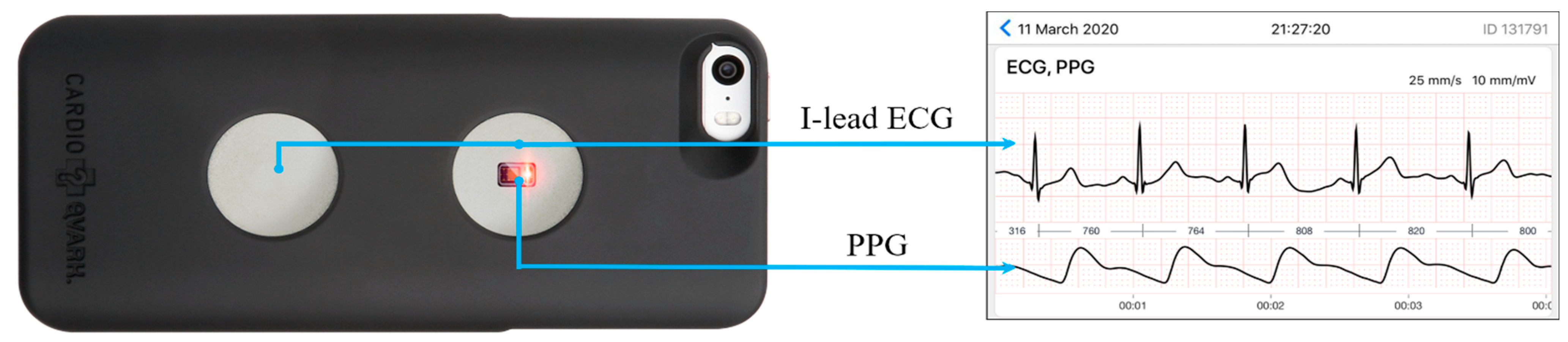 Sensors 21 03525 g001