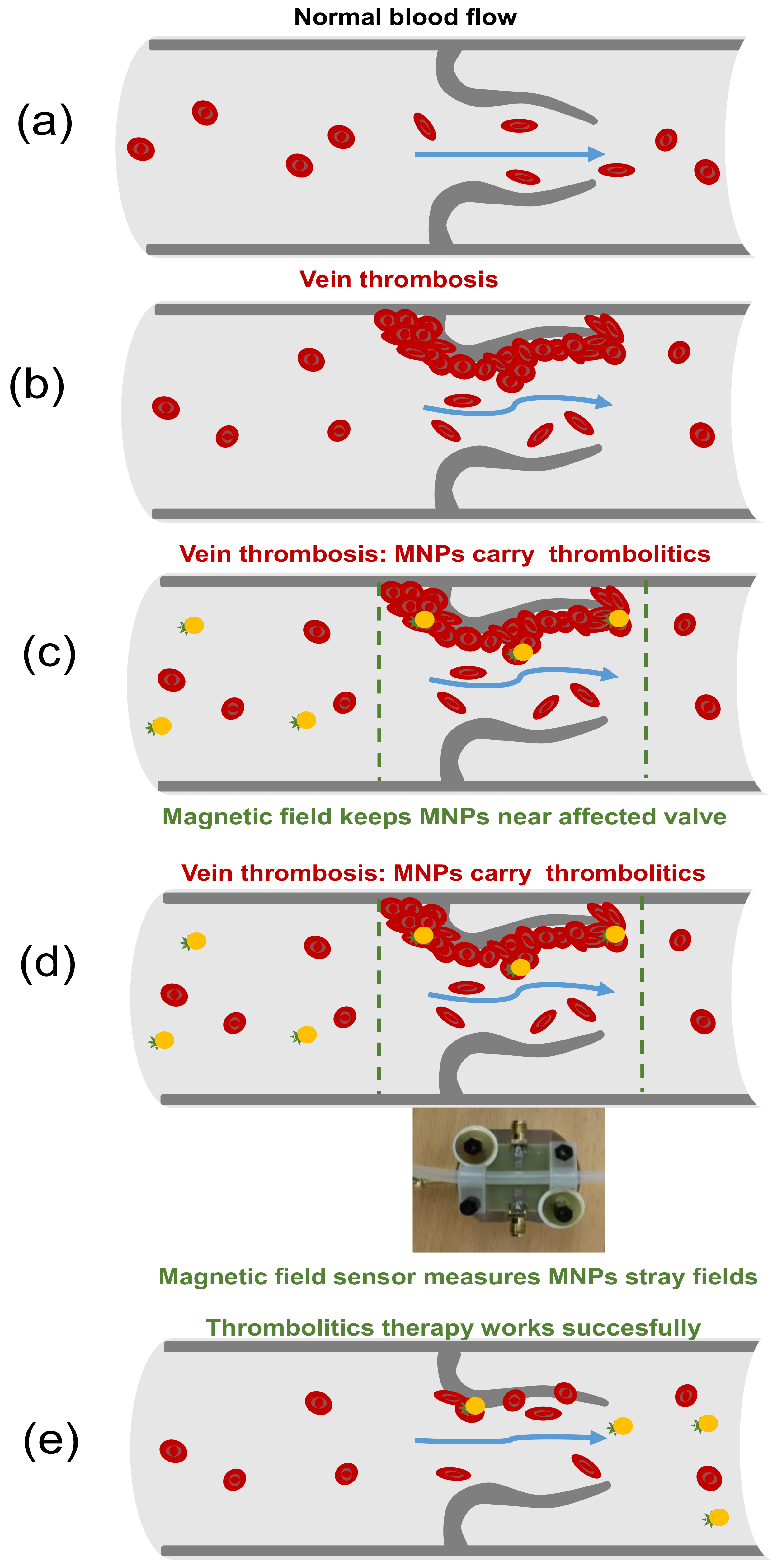 Sensors 21 03621 g010