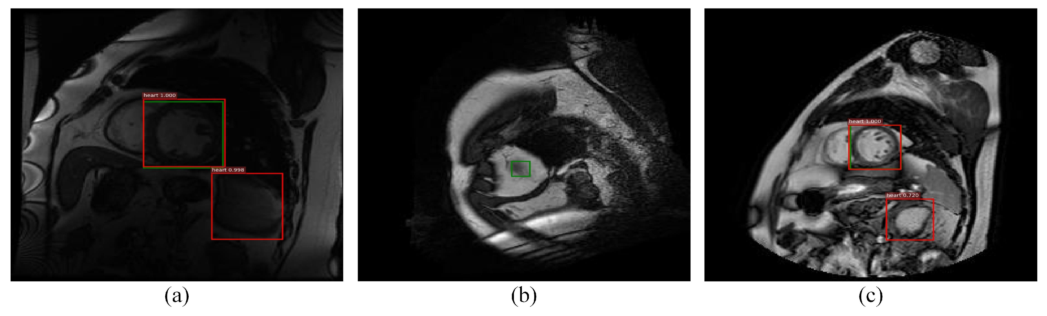 Sensors 21 03693 g013 Sensors 21 03693 g013
