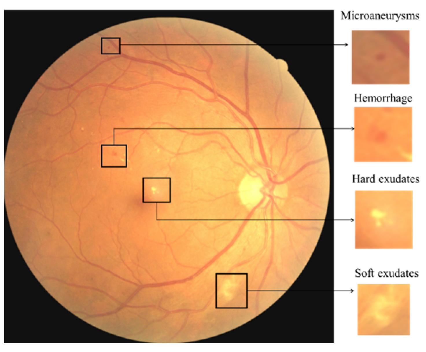 Sensors 21 03704 g001