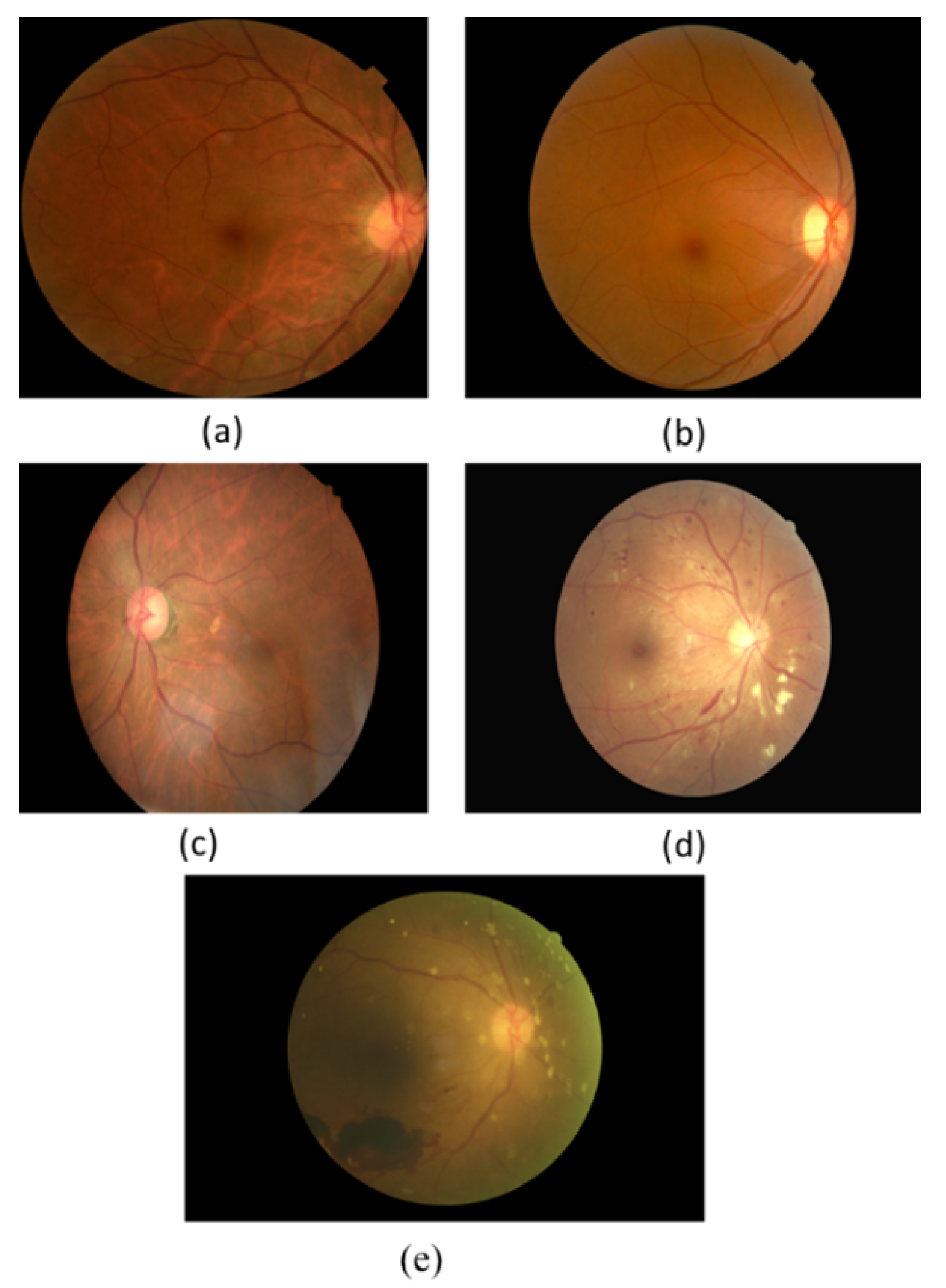 Sensors 21 03704 g002